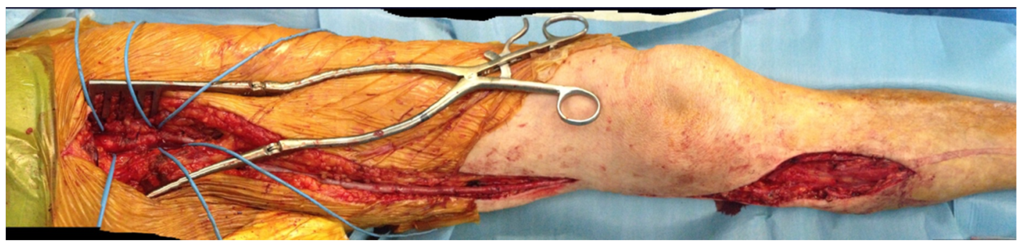 Diagnostics 12 00538 g002