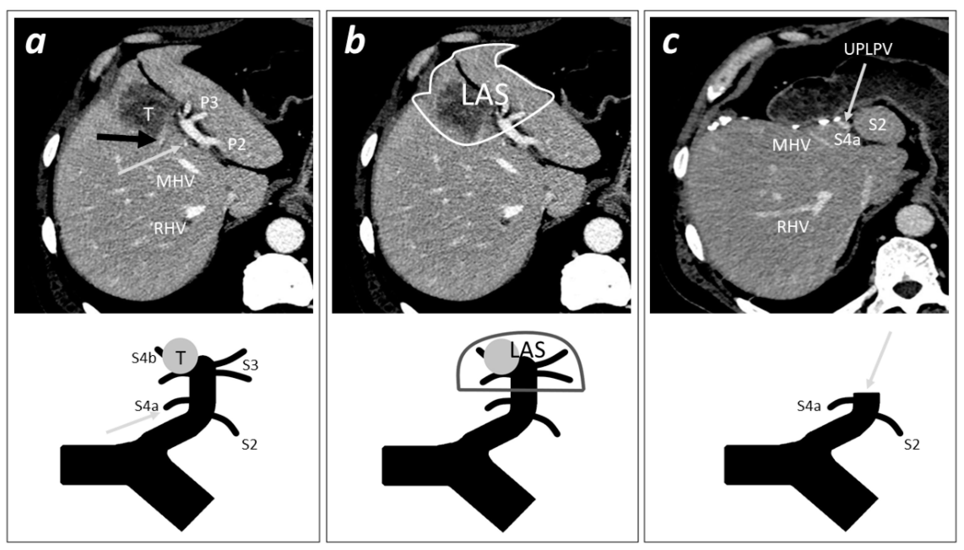 Diagnostics 12 00545 g002