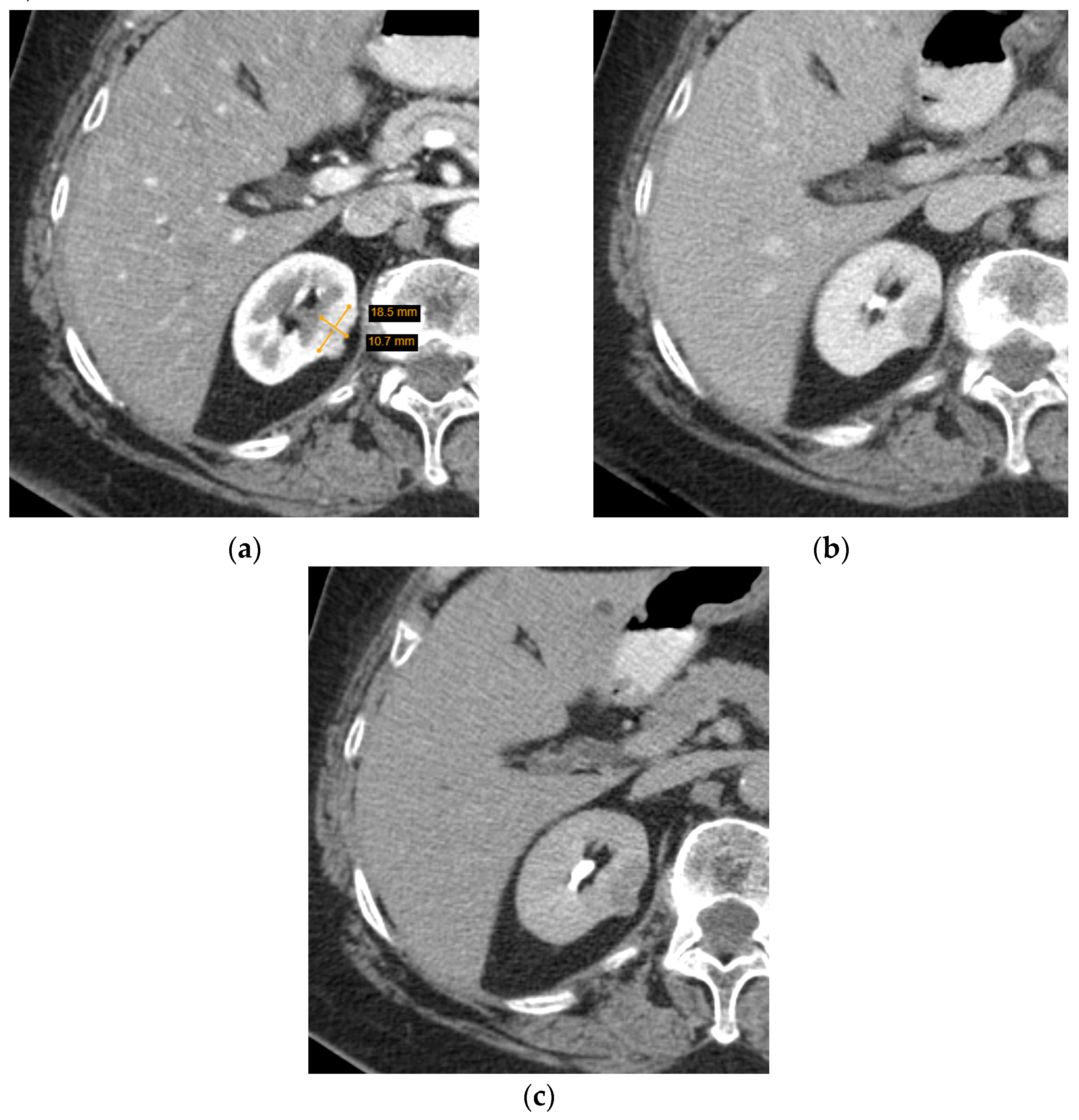 Diagnostics 12 00553 g003