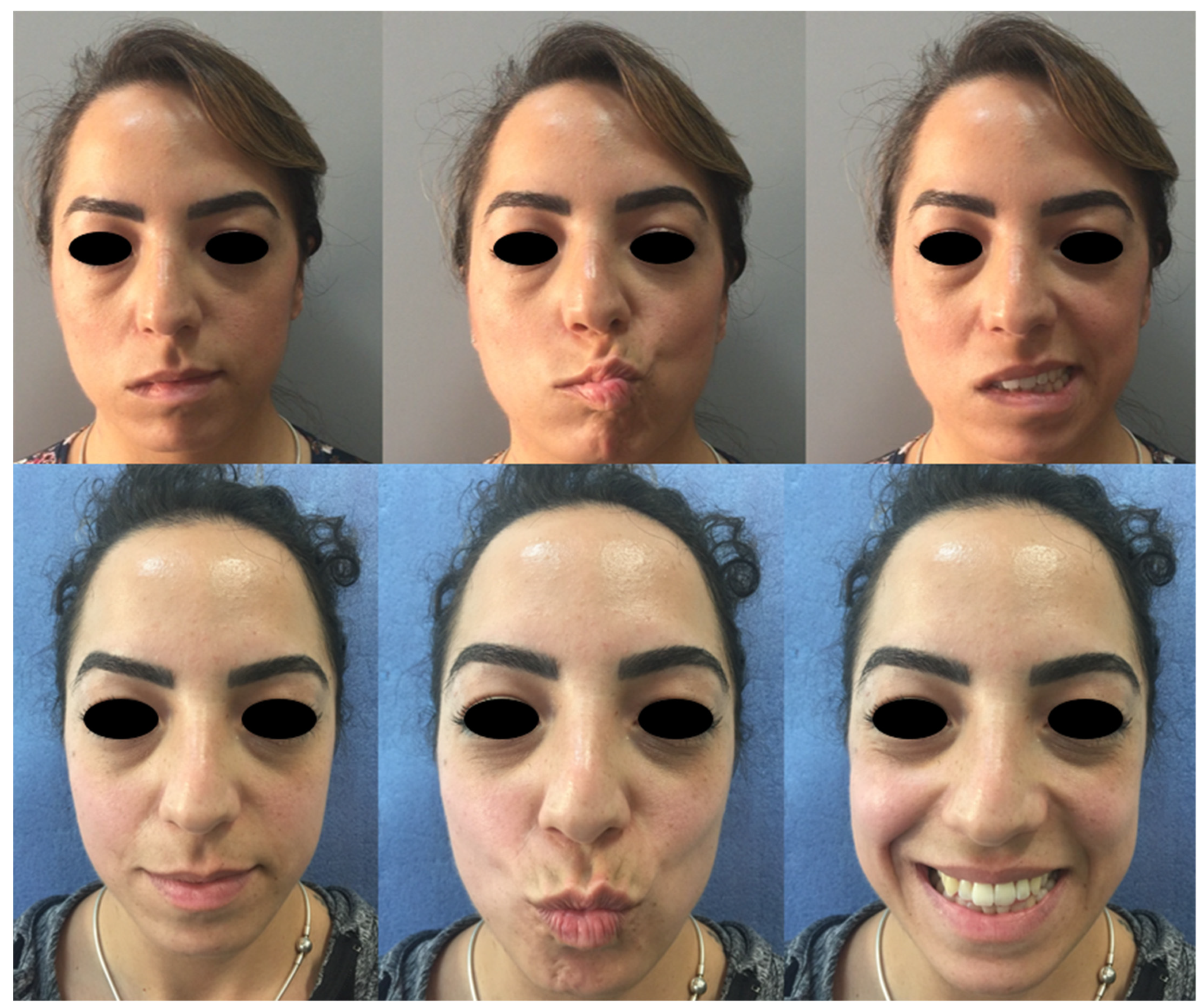 Diagnostics 12 00565 g004