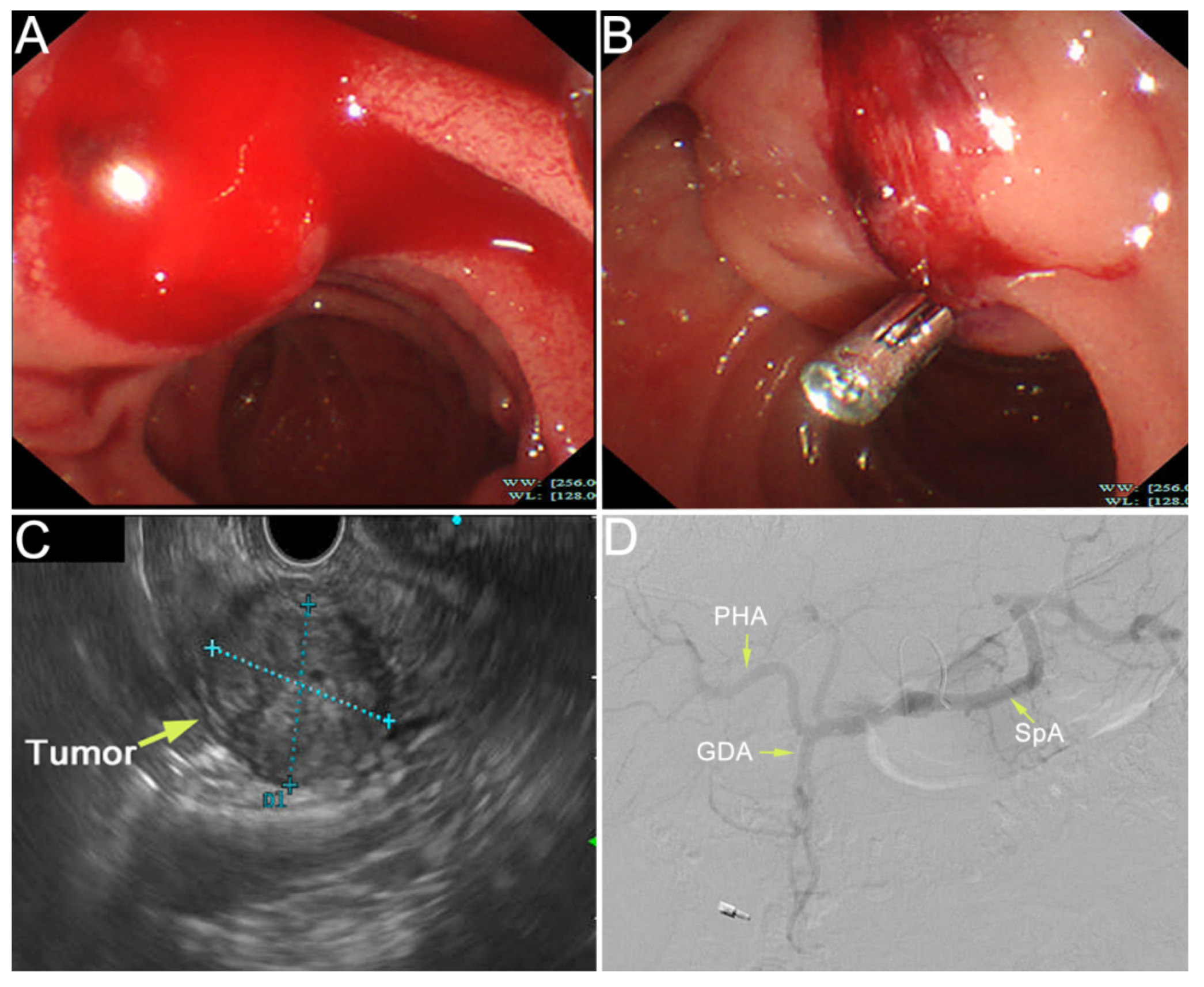 Diagnostics 12 00571 g002 Diagnostics 12 00571 g002