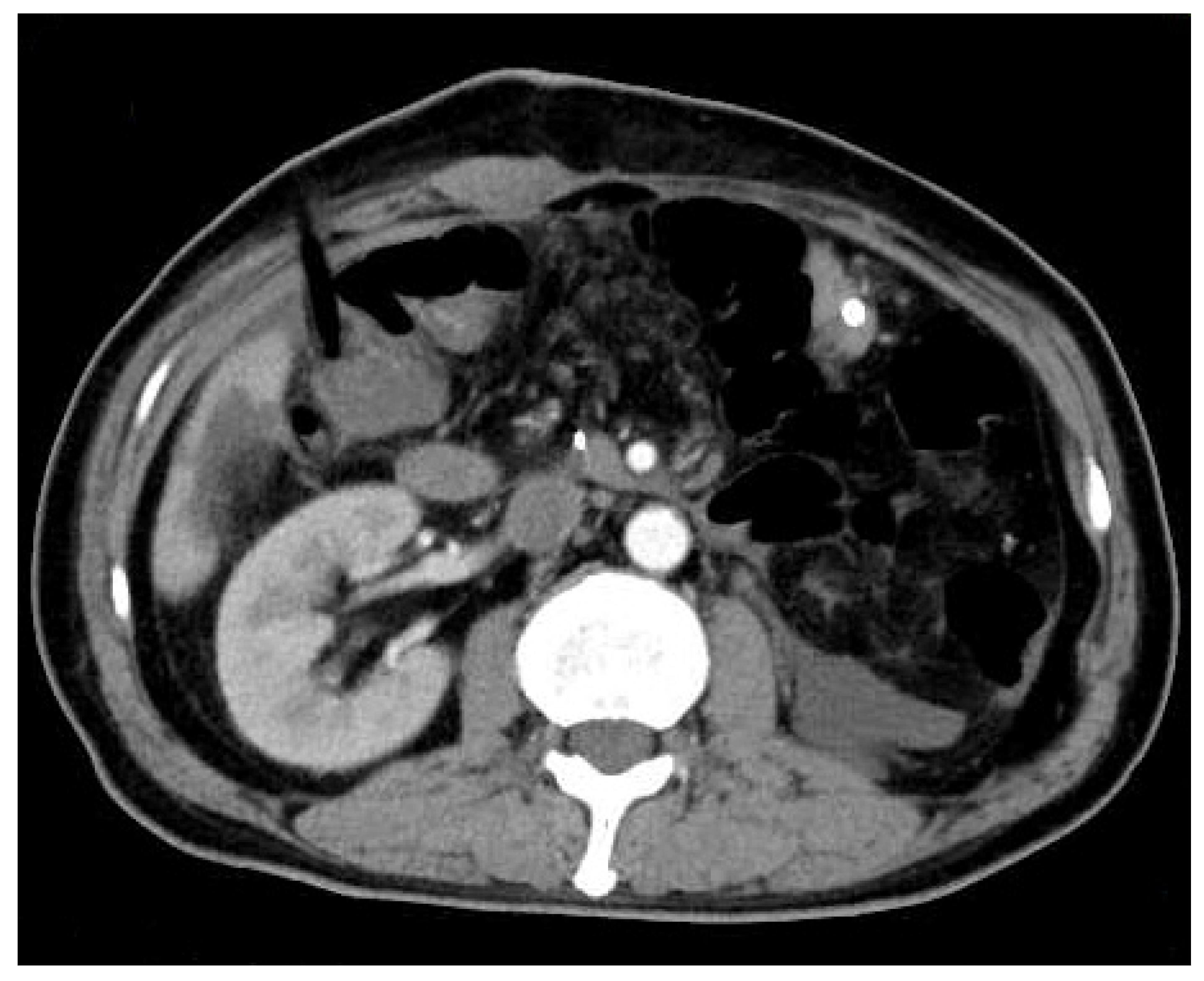 Diagnostics 12 00571 g004 Diagnostics 12 00571 g004