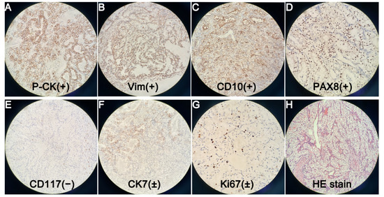 Diagnostics 12 00571 g005
