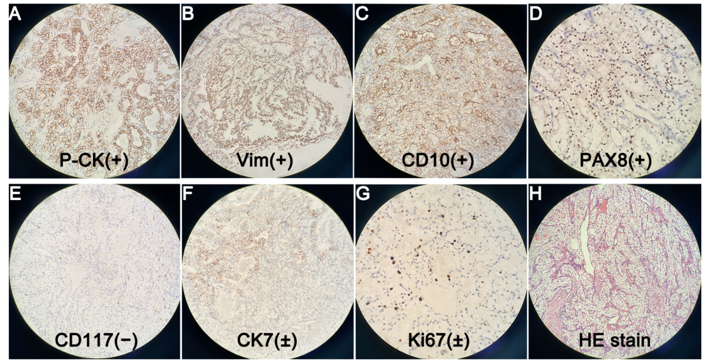 Diagnostics 12 00571 g005 Diagnostics 12 00571 g005