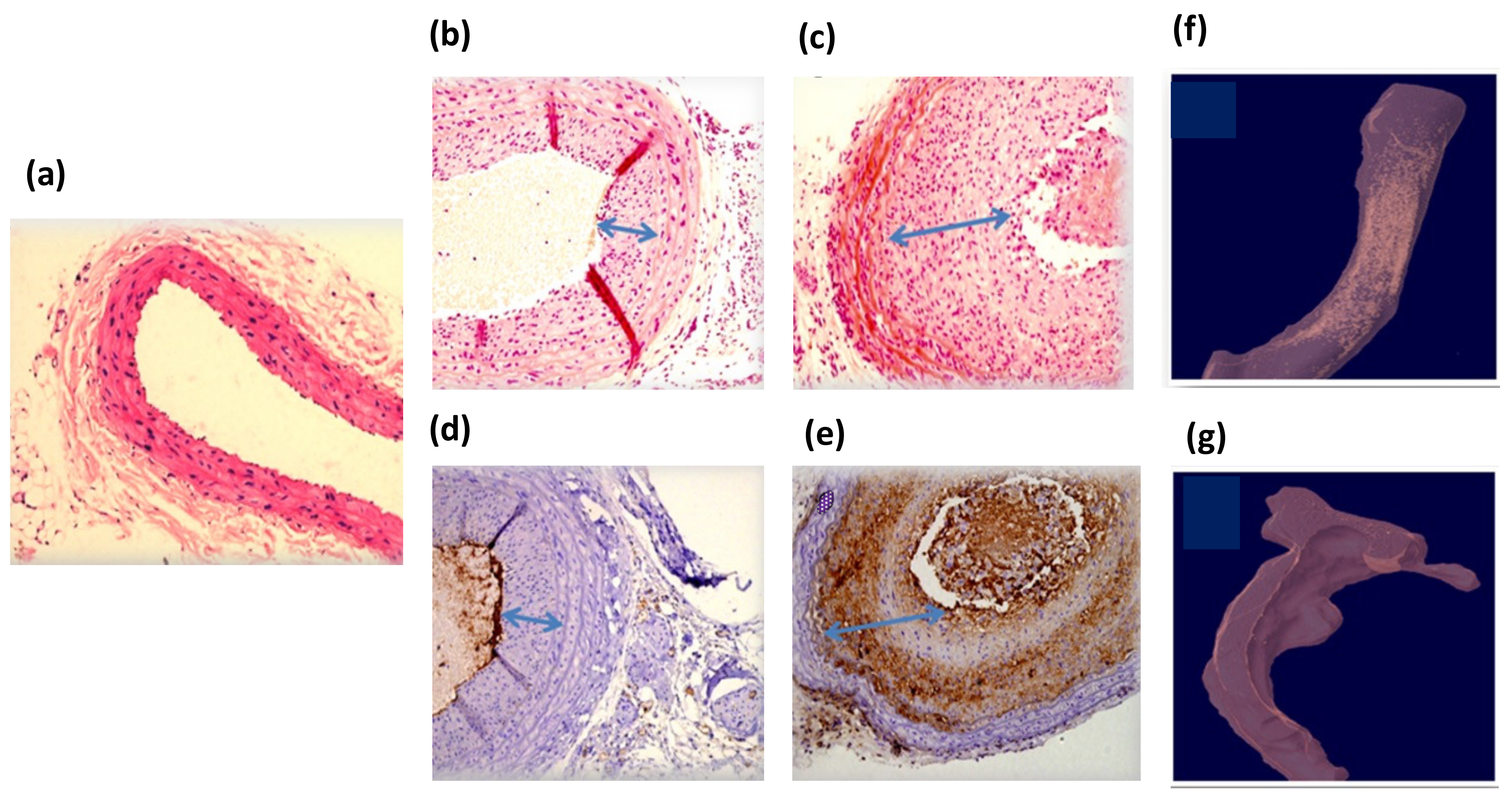 Diagnostics 12 00577 g005