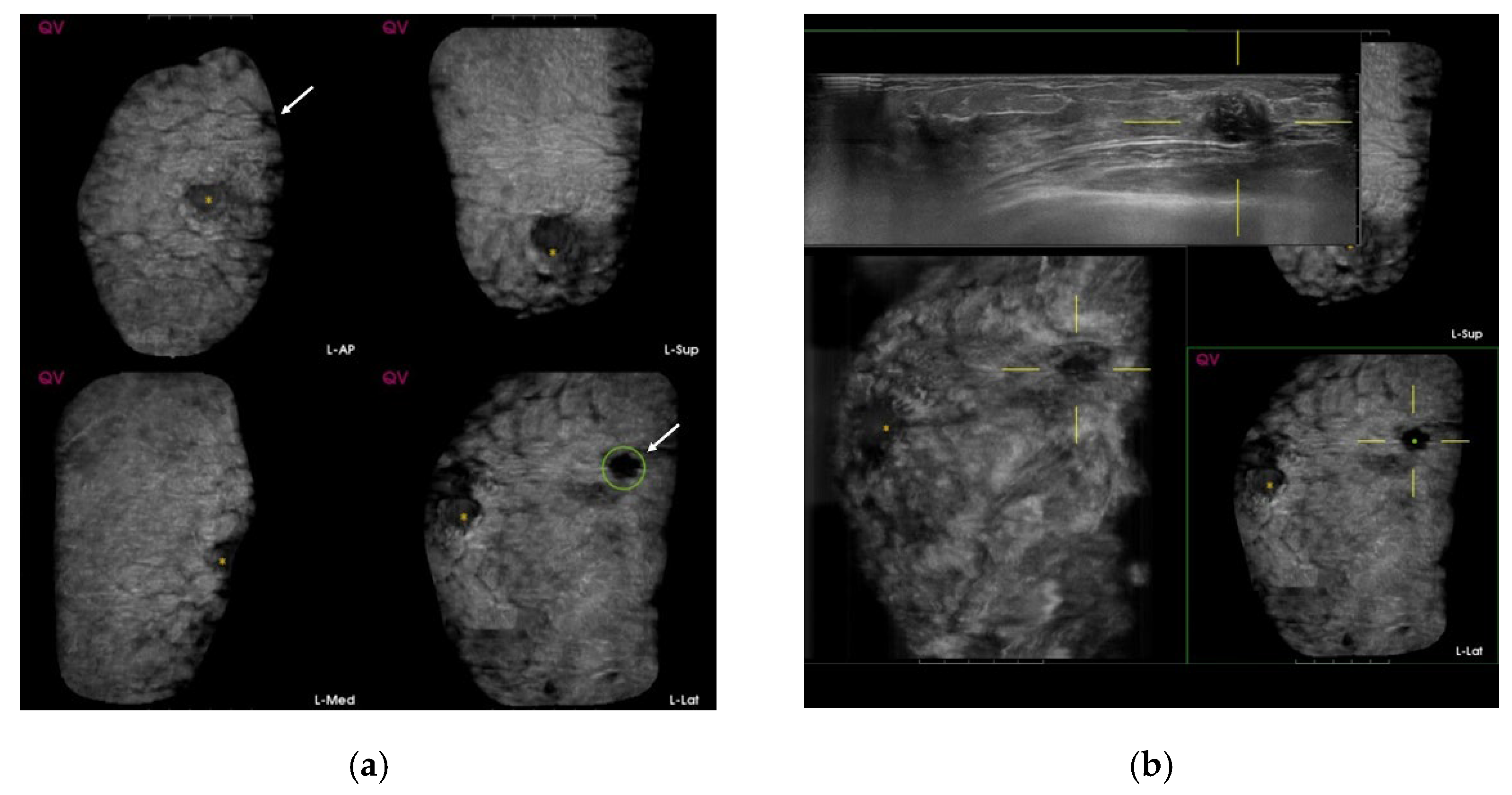 Diagnostics 12 00583 g001