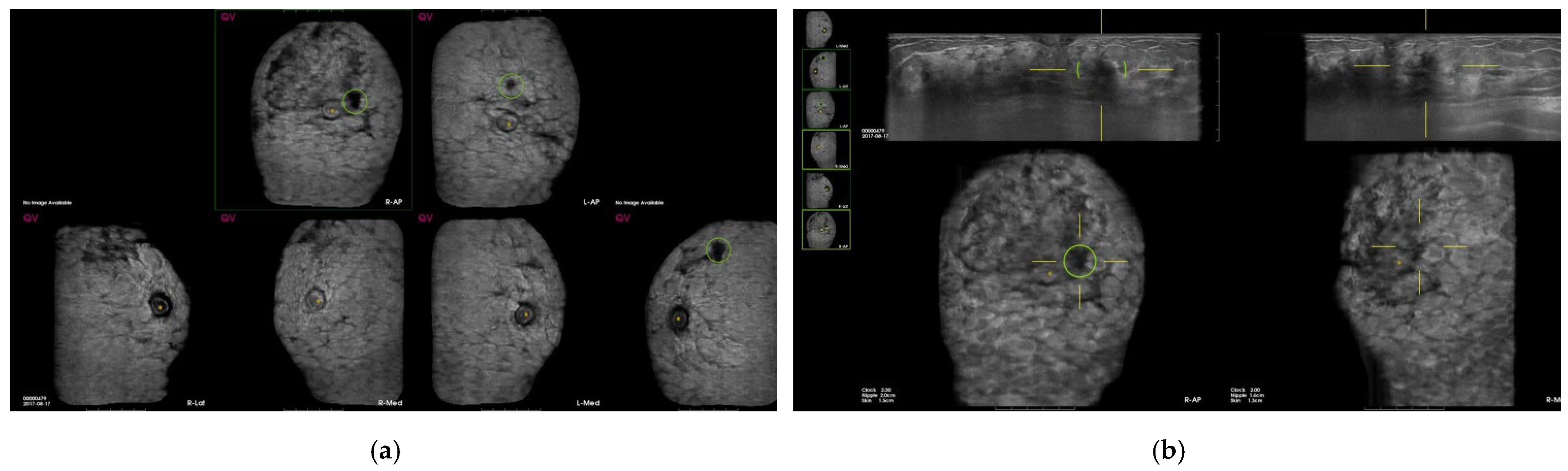 Diagnostics 12 00583 g002a