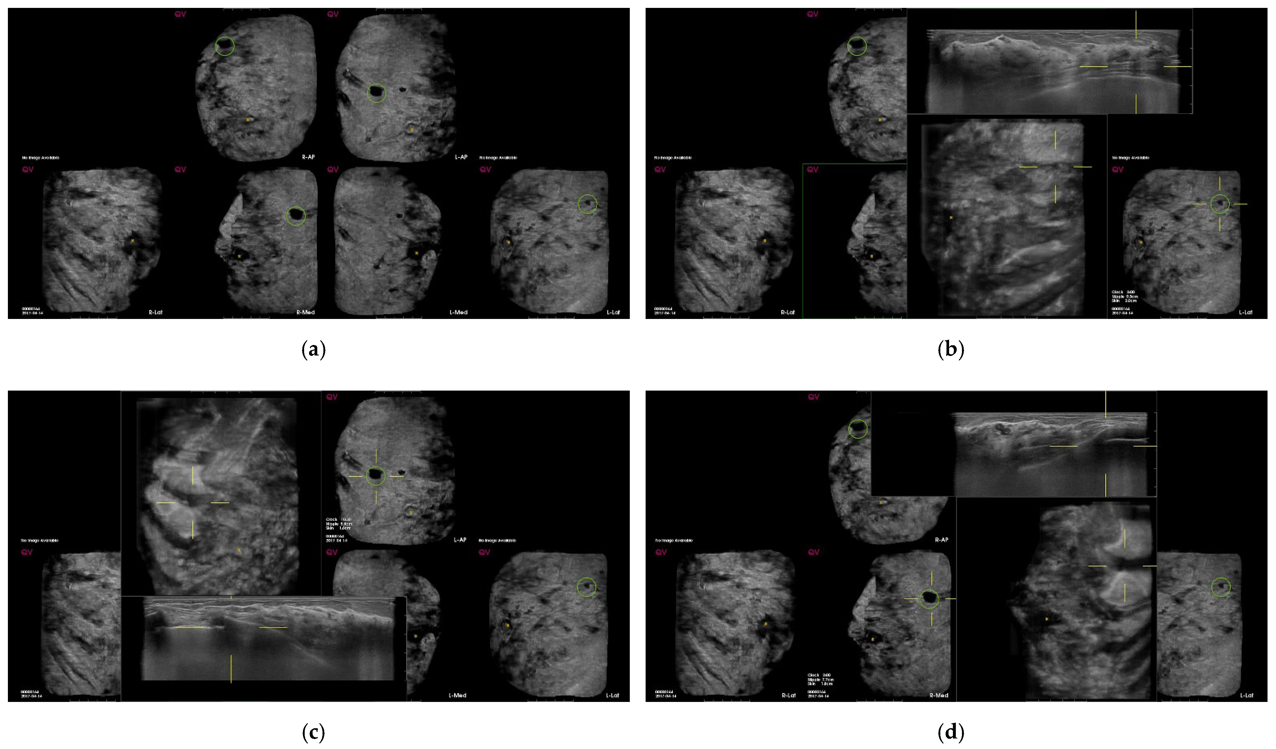 Diagnostics 12 00583 g003