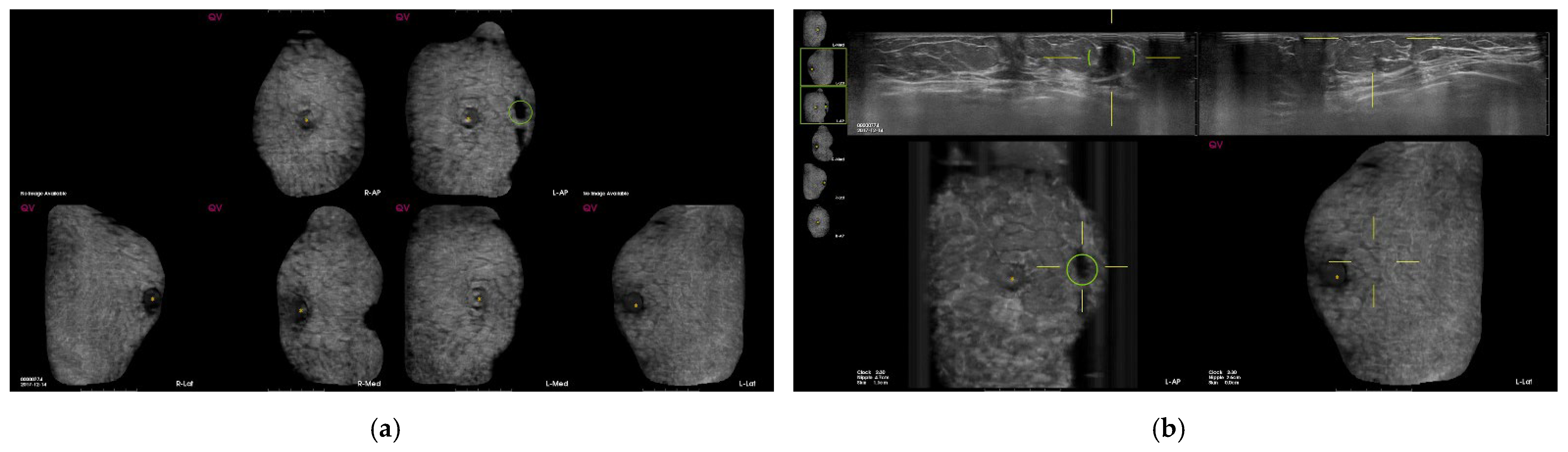 Diagnostics 12 00583 g004