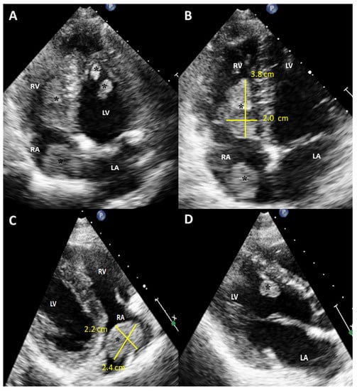 Diagnostics 12 00587 g001 550