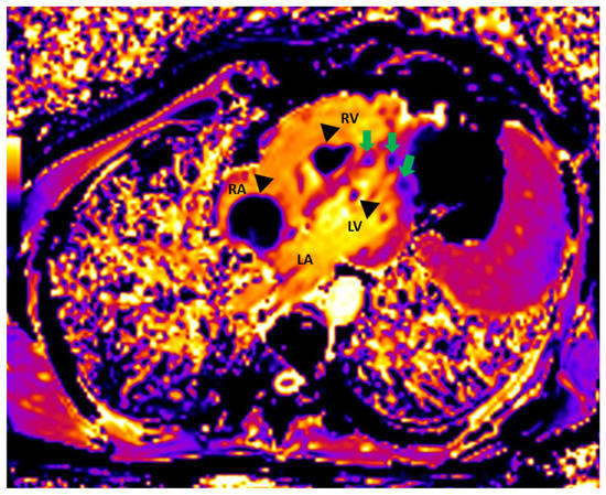 Diagnostics 12 00587 g002 550