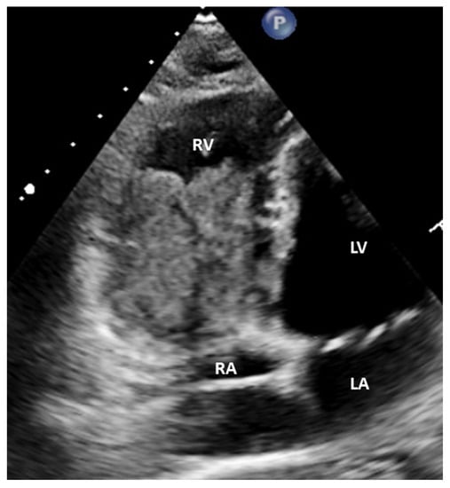 Diagnostics 12 00587 g003 550