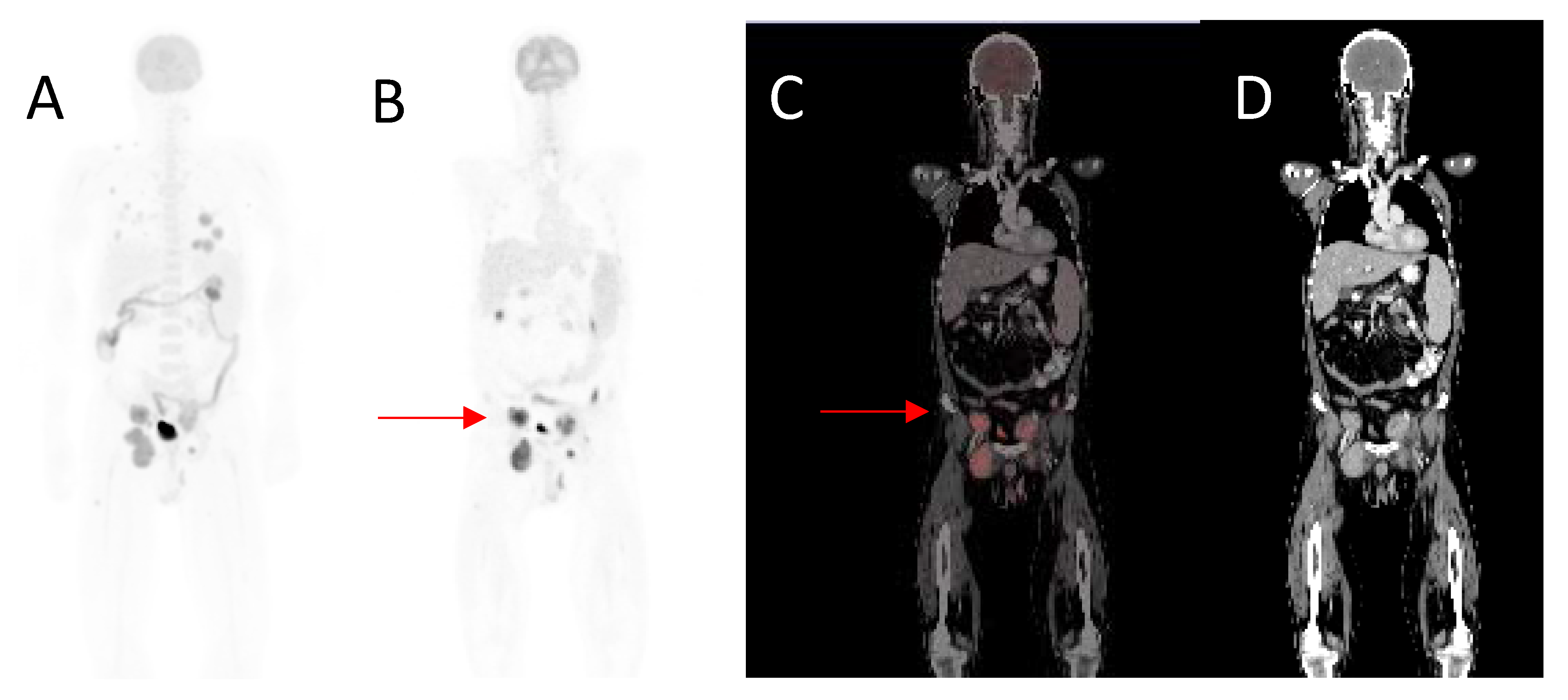 Diagnostics 12 00595 g003