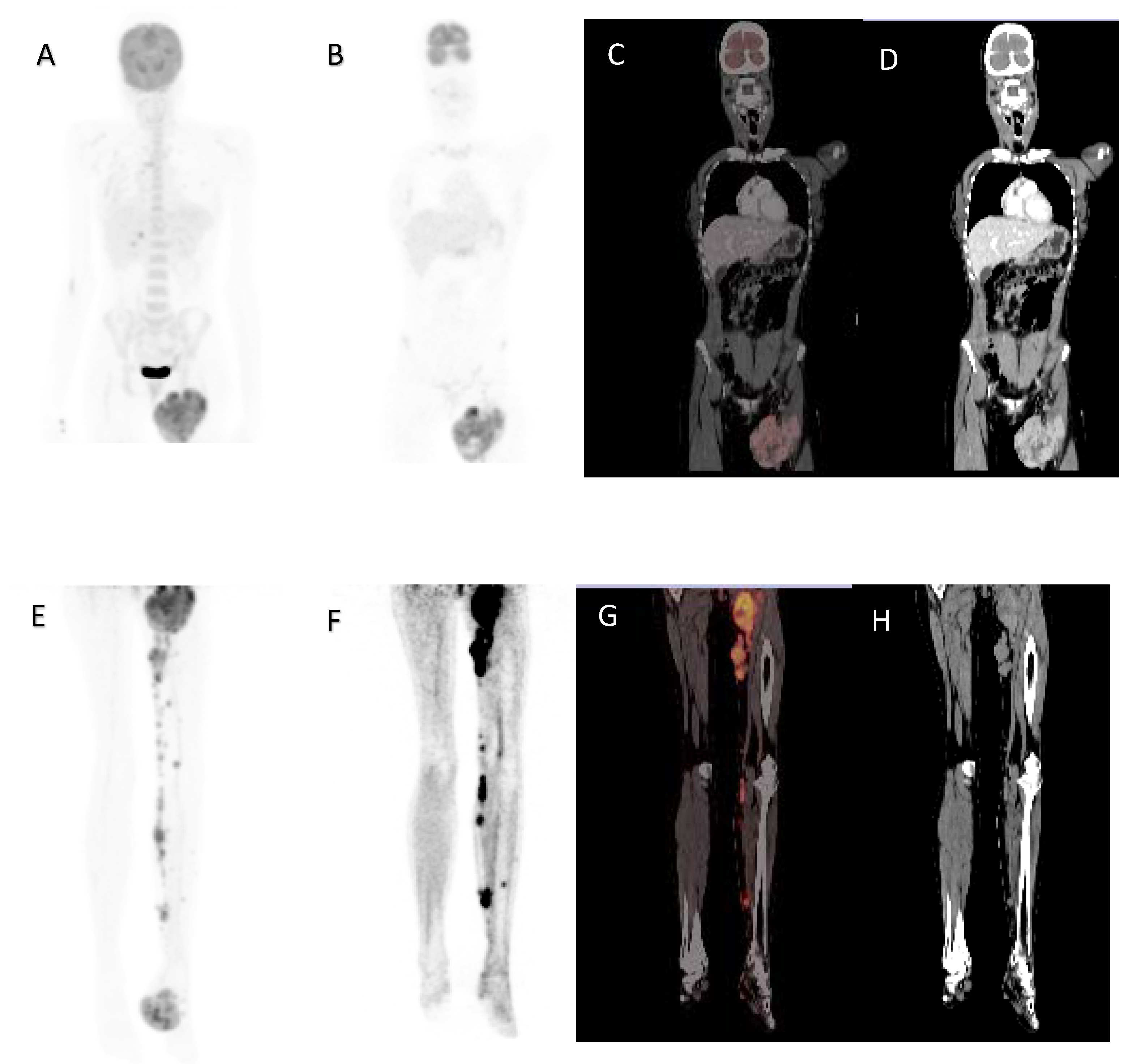 Diagnostics 12 00595 g004