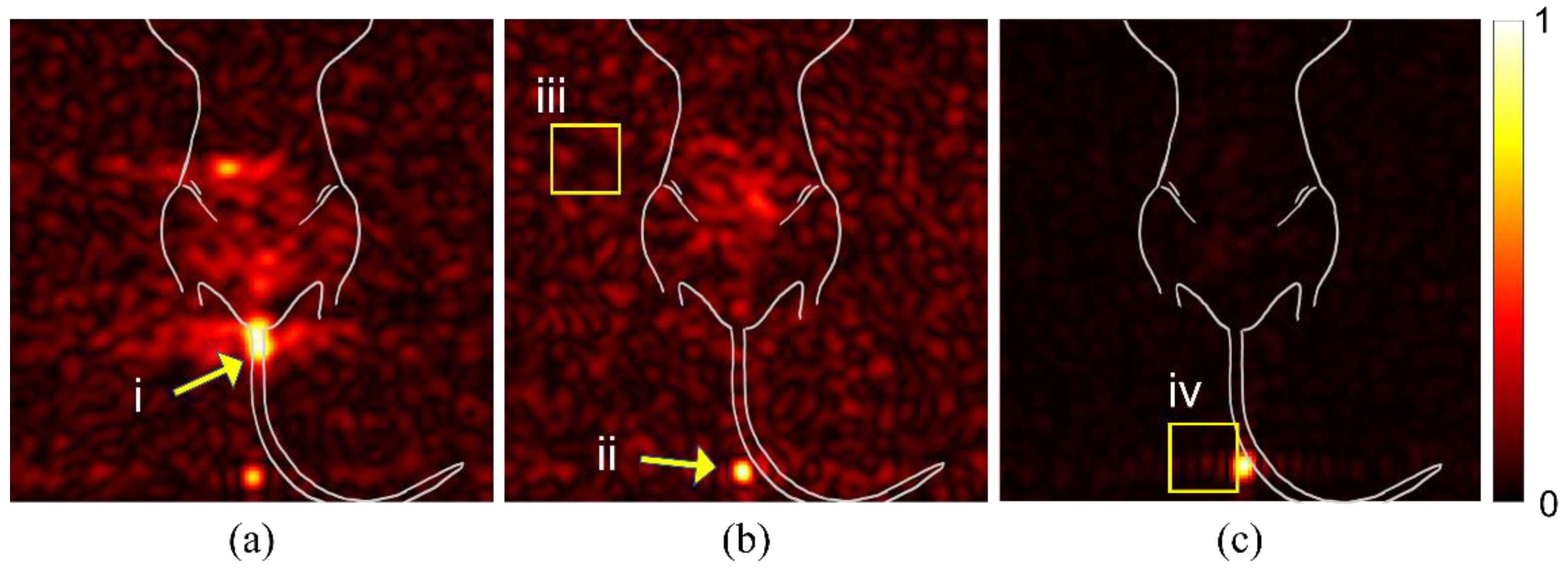 Diagnostics 12 00610 g001