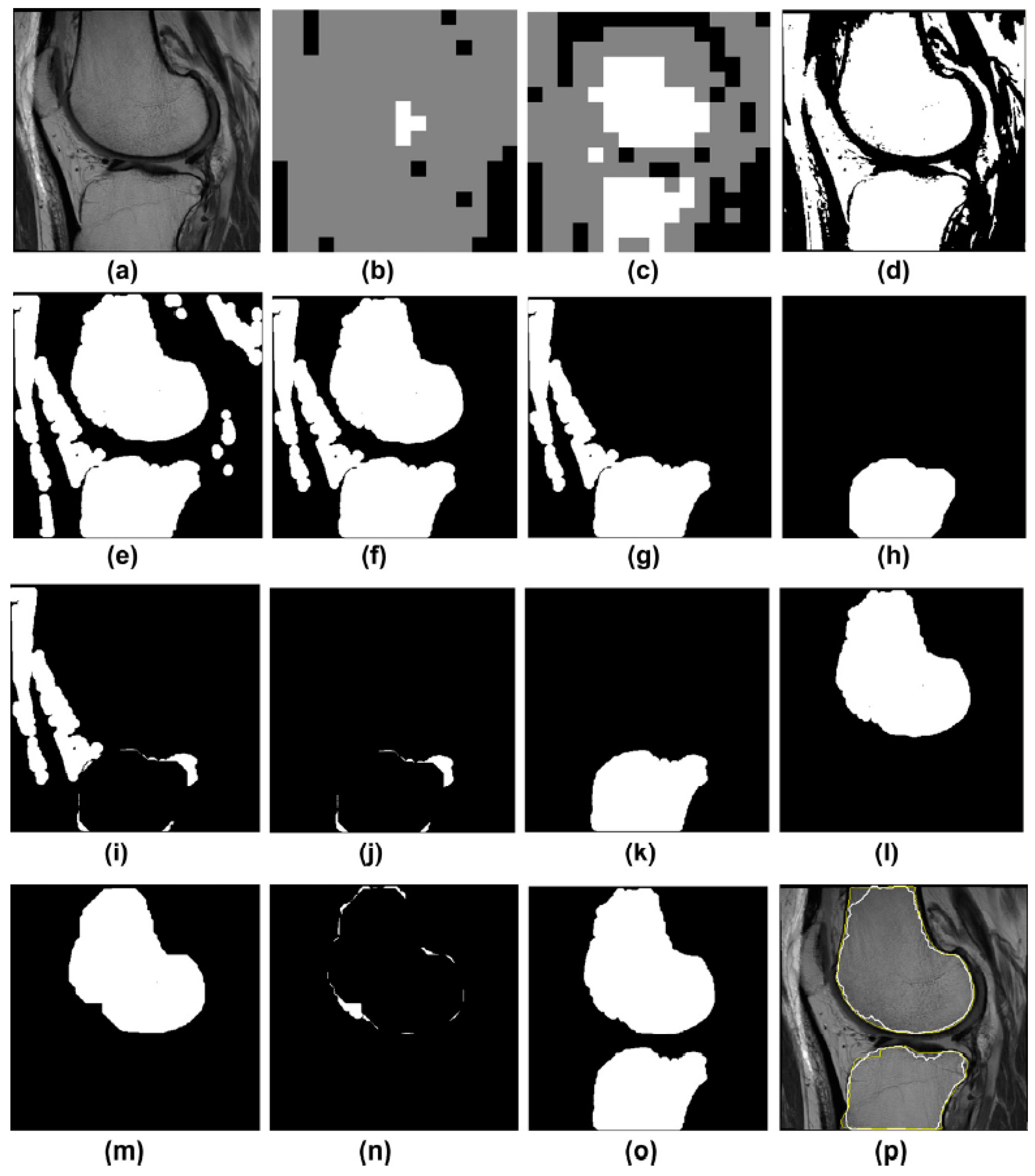 Diagnostics 12 00611 g004