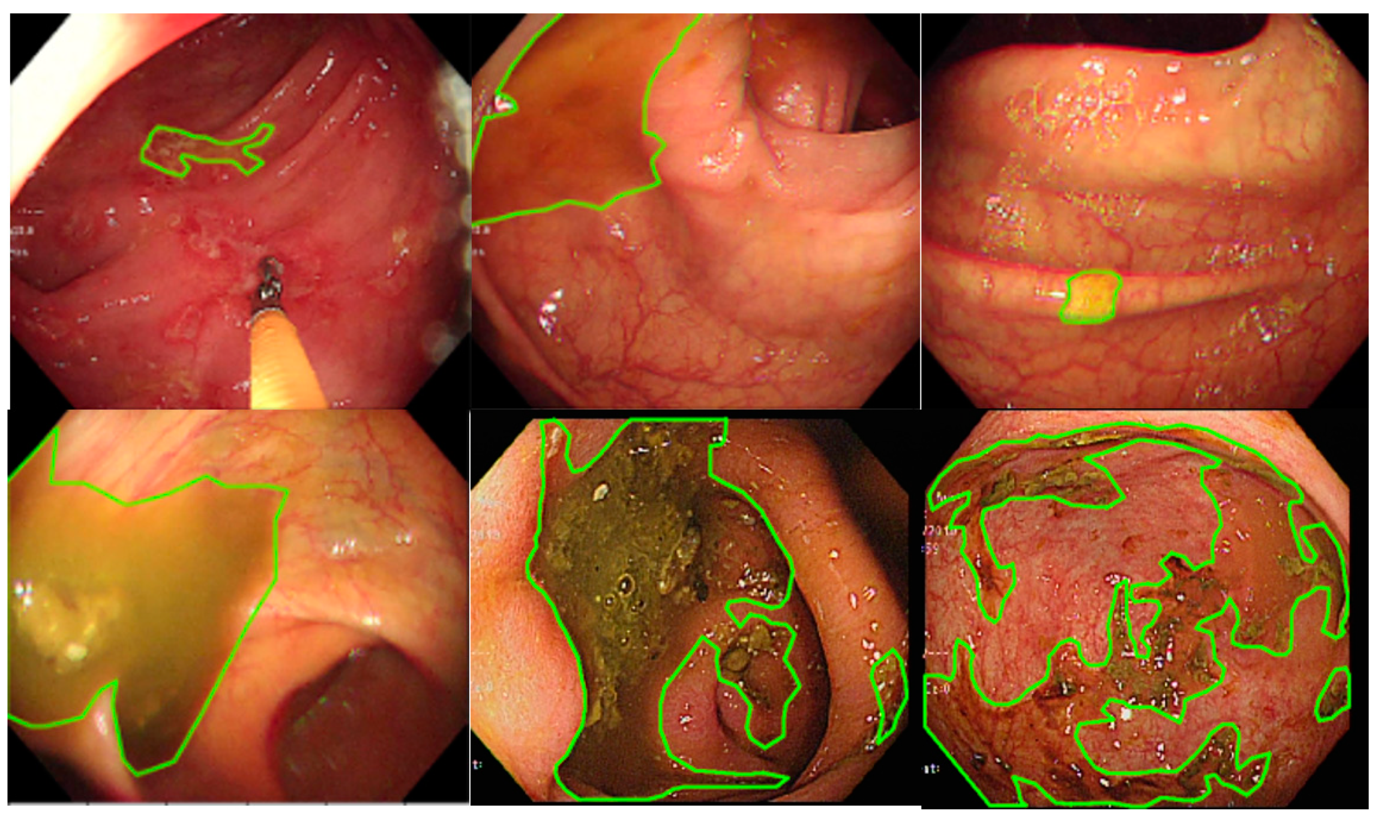 Diagnostics 12 00613 g001