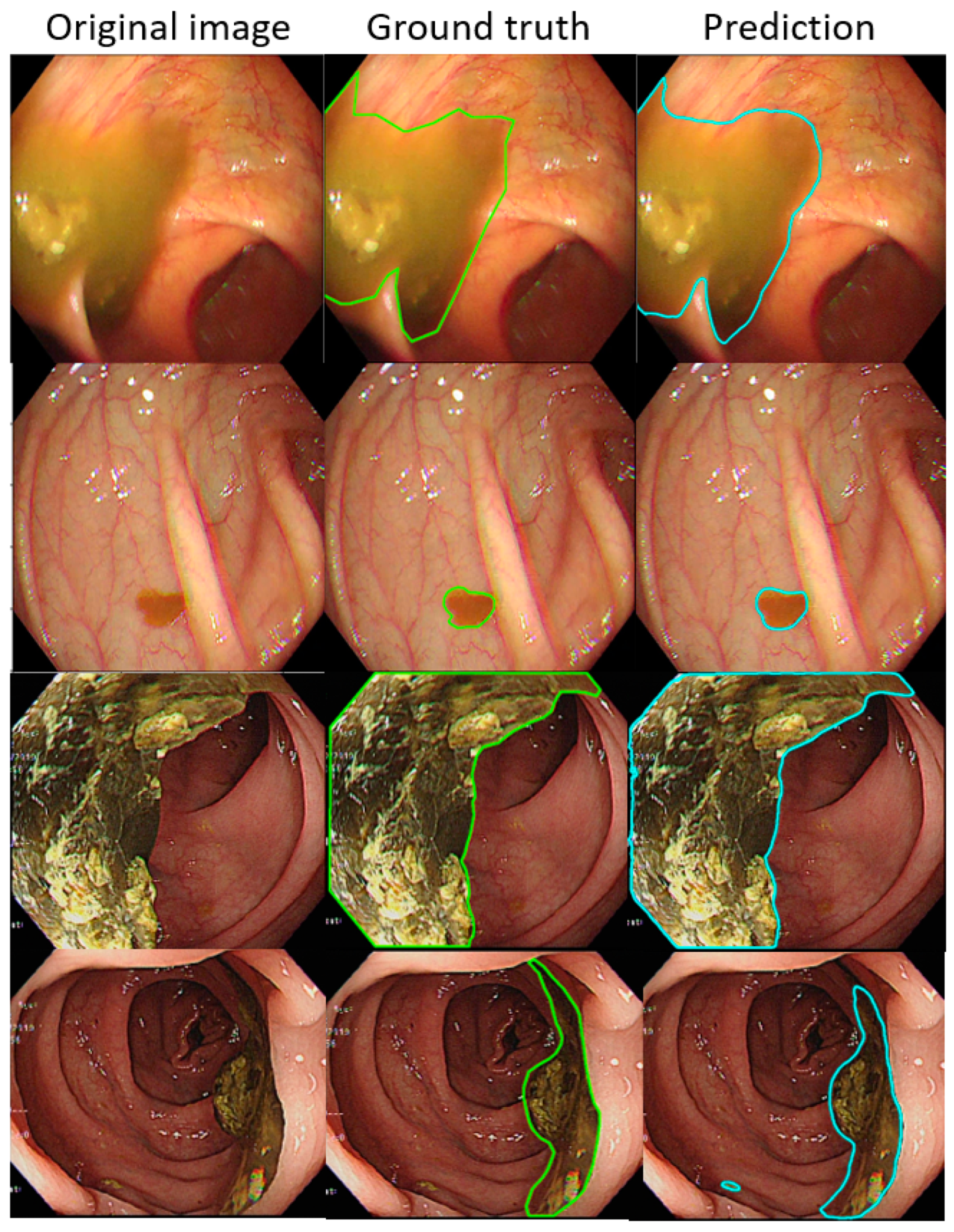 Diagnostics 12 00613 g004
