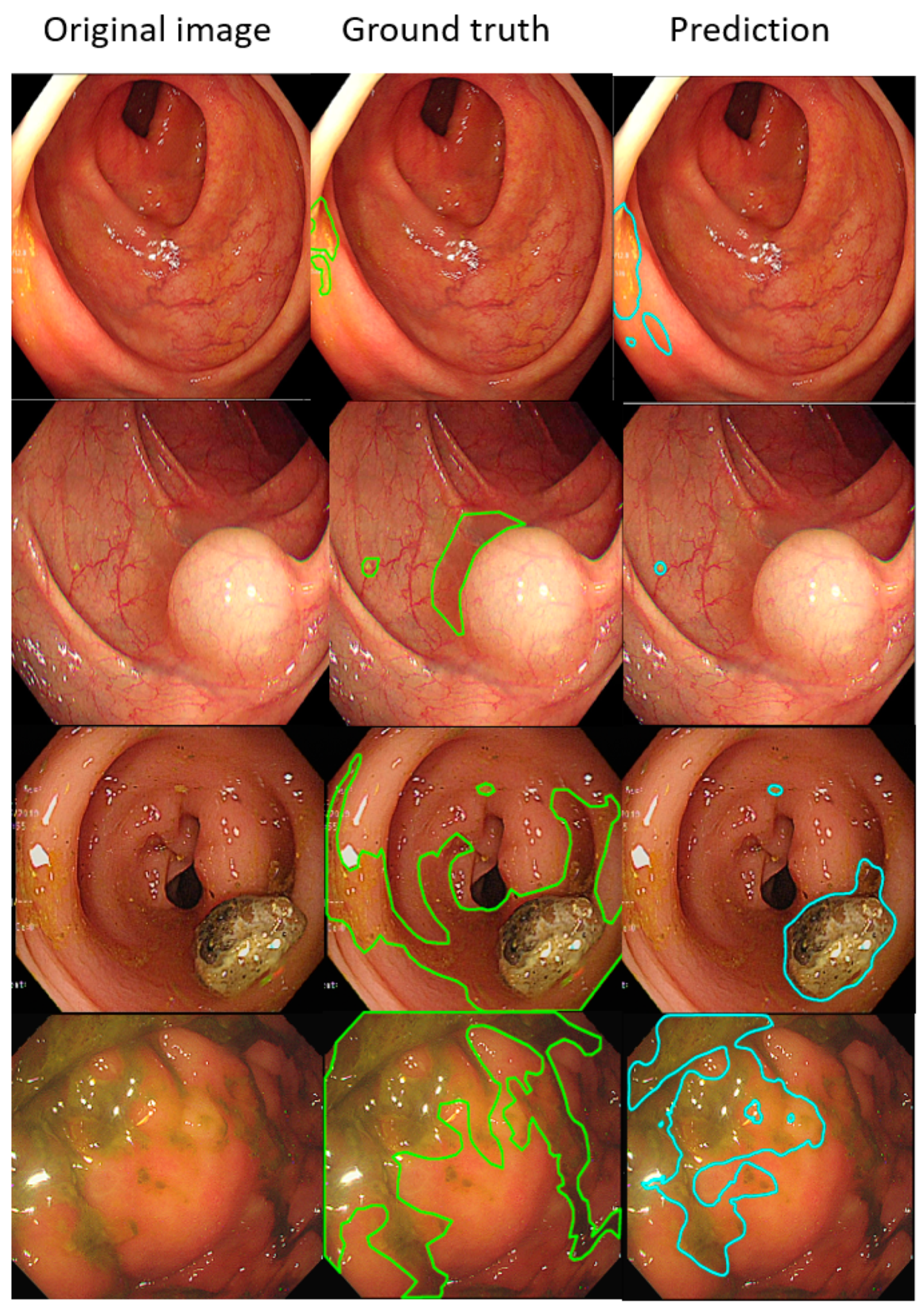Diagnostics 12 00613 g005