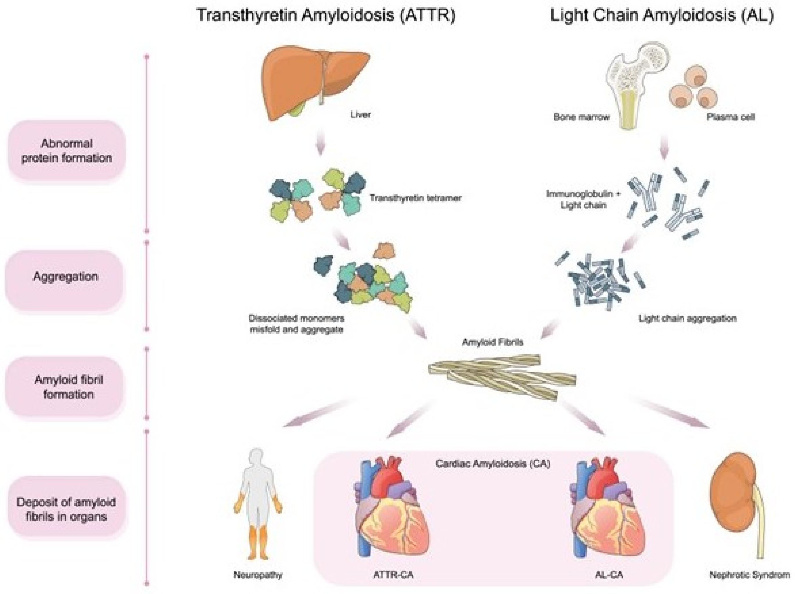 Multimodal Imaging and Biomarkers in Cardiac Amyloidosis | MDPI