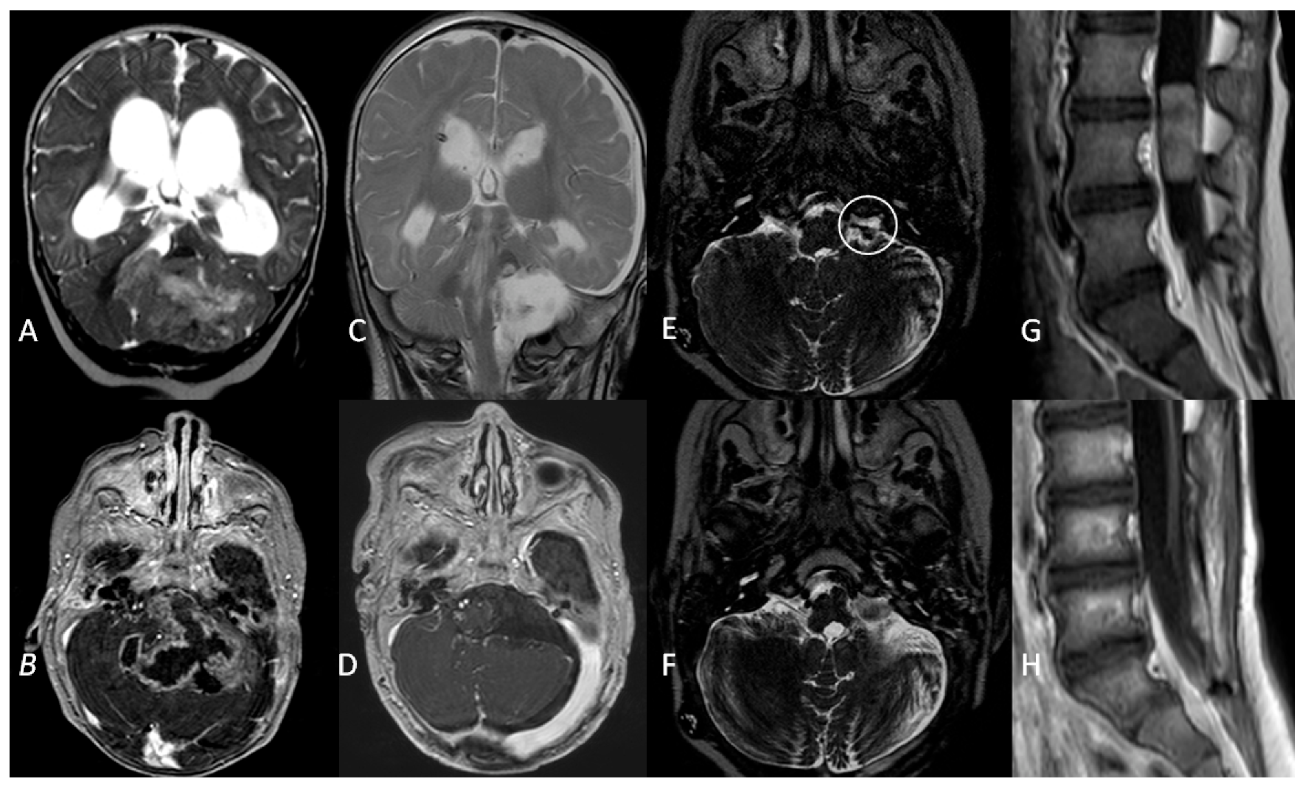 Diagnostics 12 00635 g004