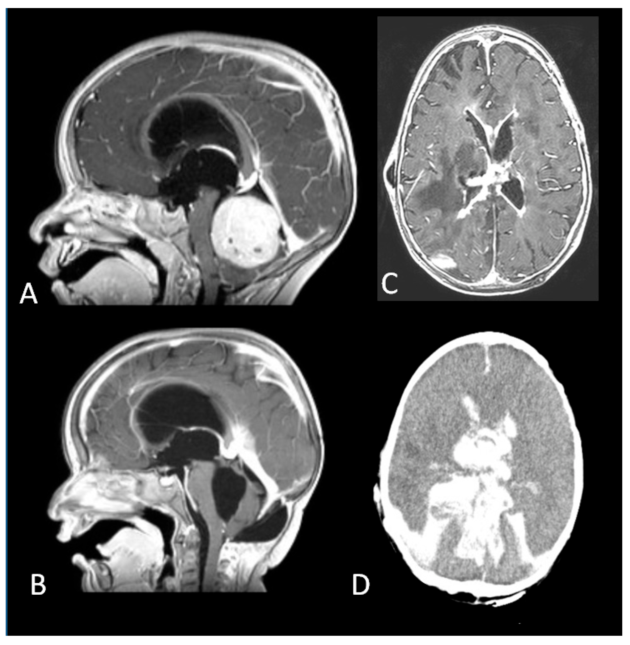Diagnostics 12 00635 g005