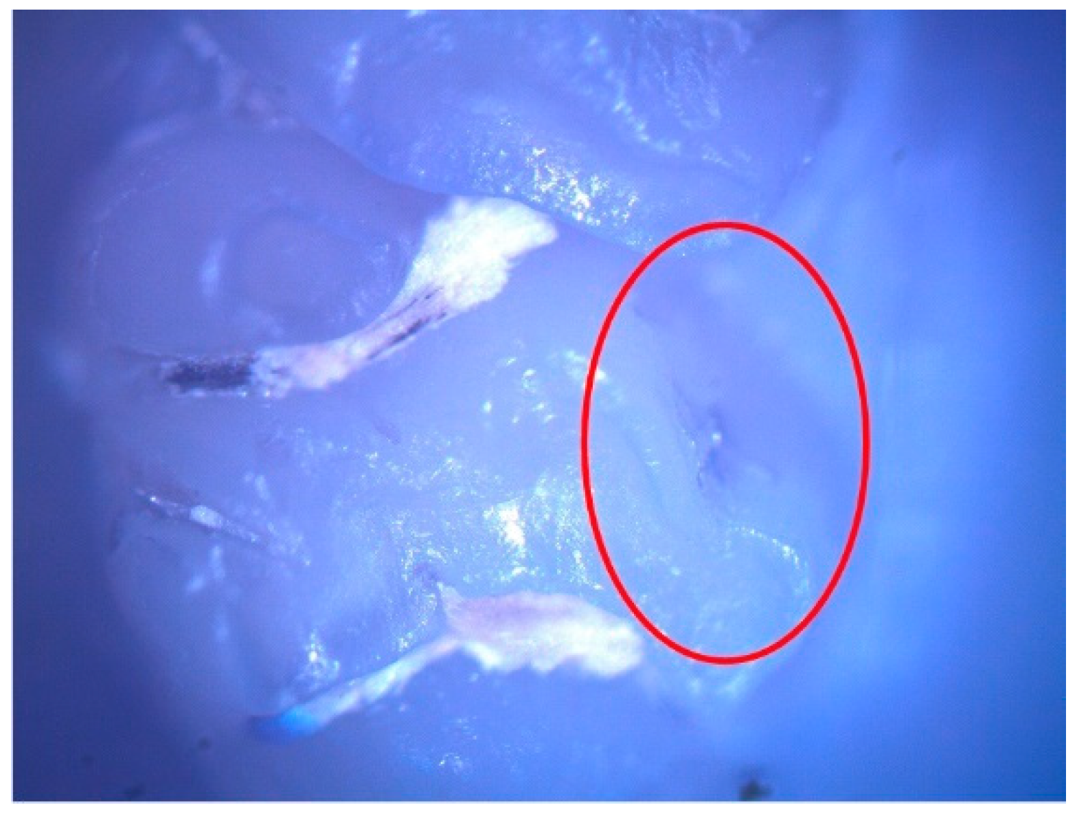 Diagnostics 12 00636 g003