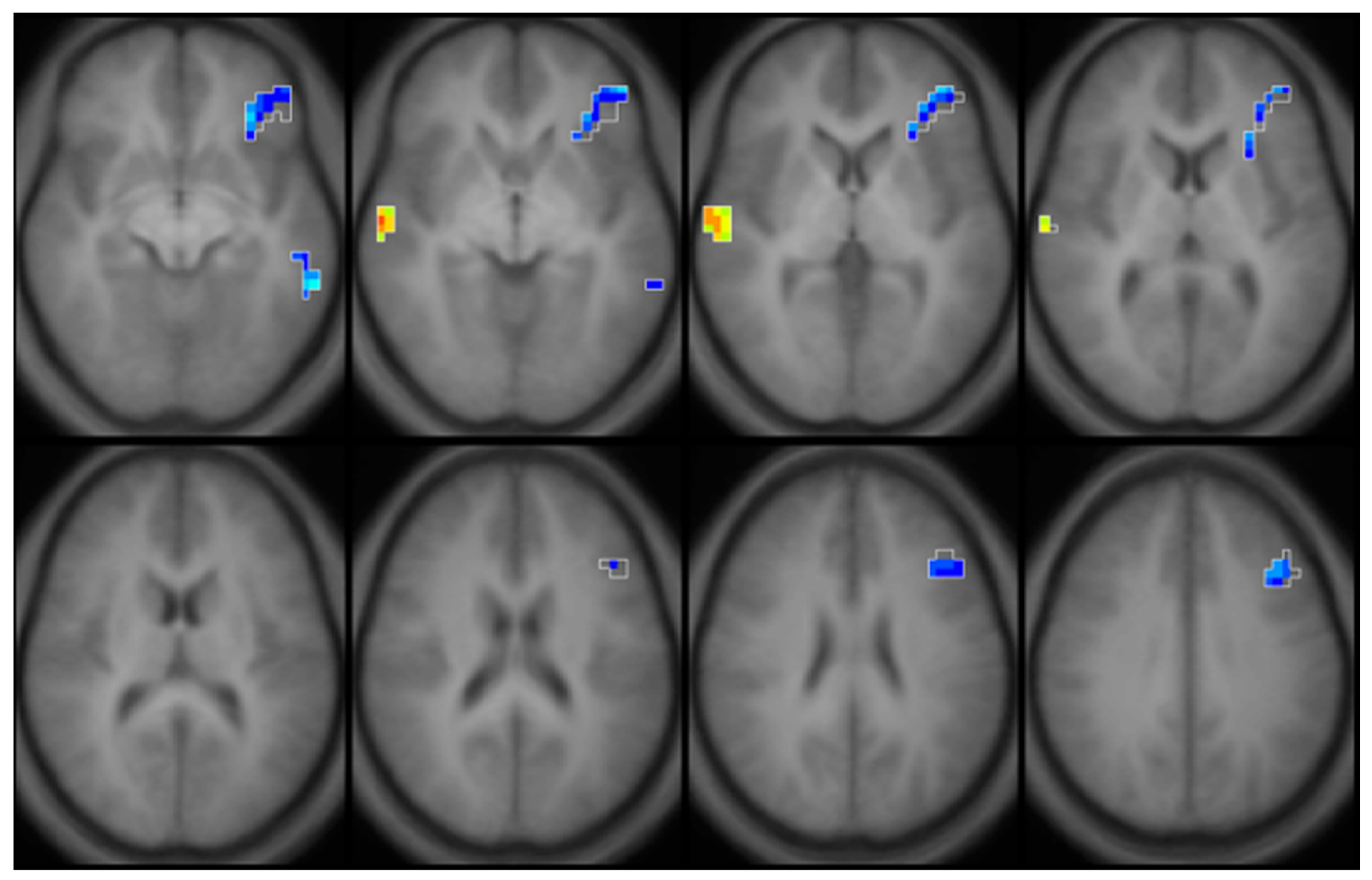 Diagnostics 12 00641 g005