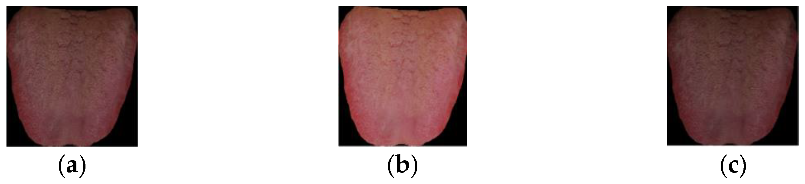 Diagnostics 12 00653 g004