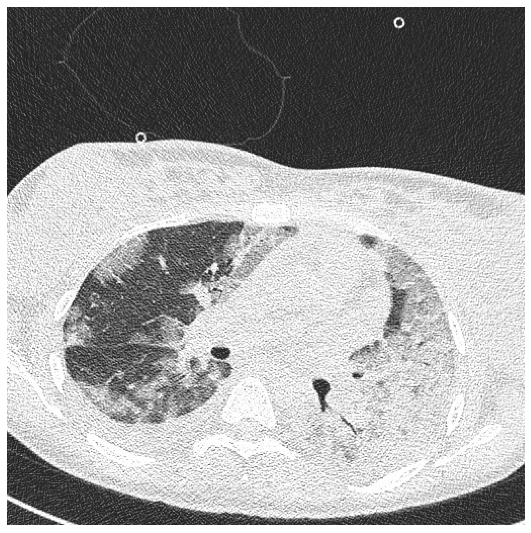 Diagnostics 12 00655 g004 Diagnostics 12 00655 g004