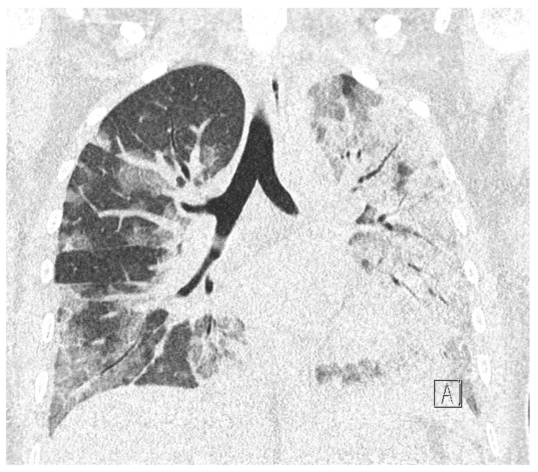 Diagnostics 12 00655 g005 Diagnostics 12 00655 g005