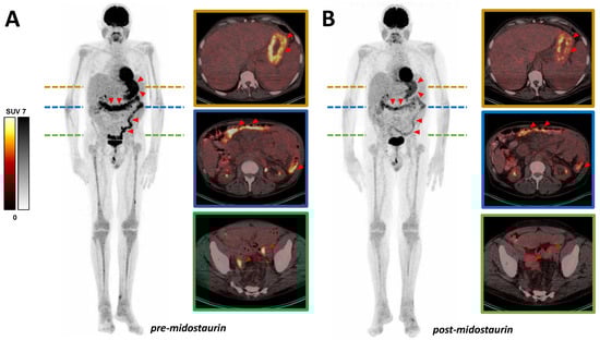 Diagnostics 12 00680 g001 550