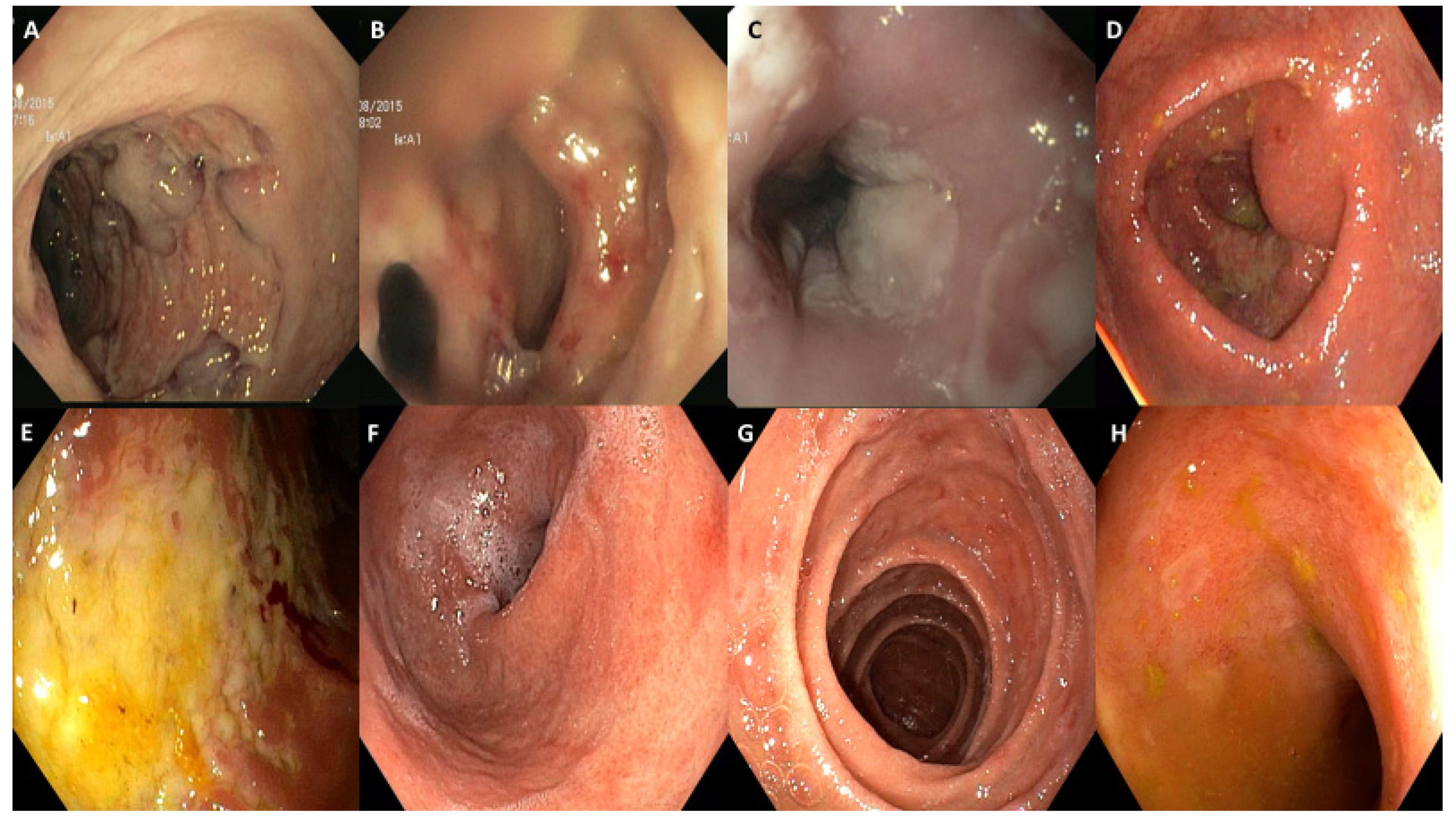 Diagnostics 12 00685 g001