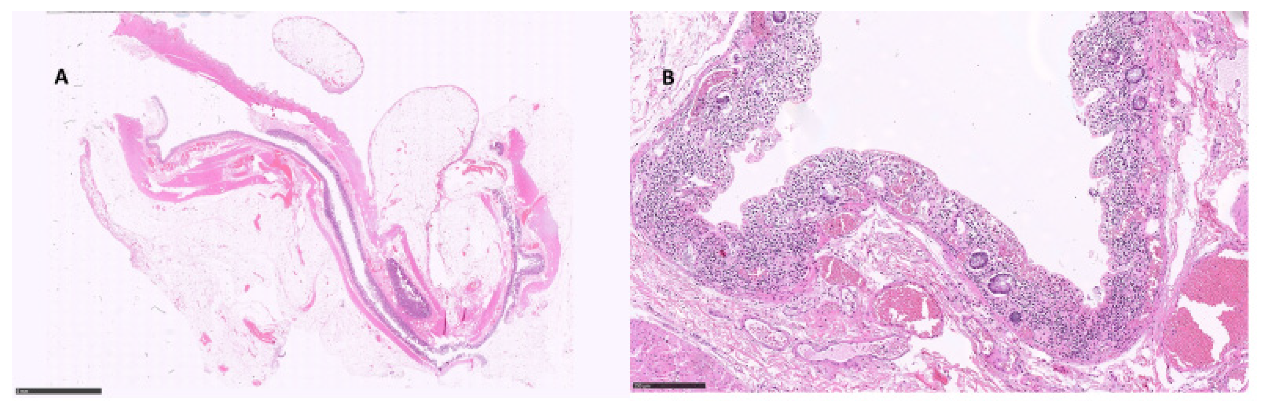 Diagnostics 12 00685 g004