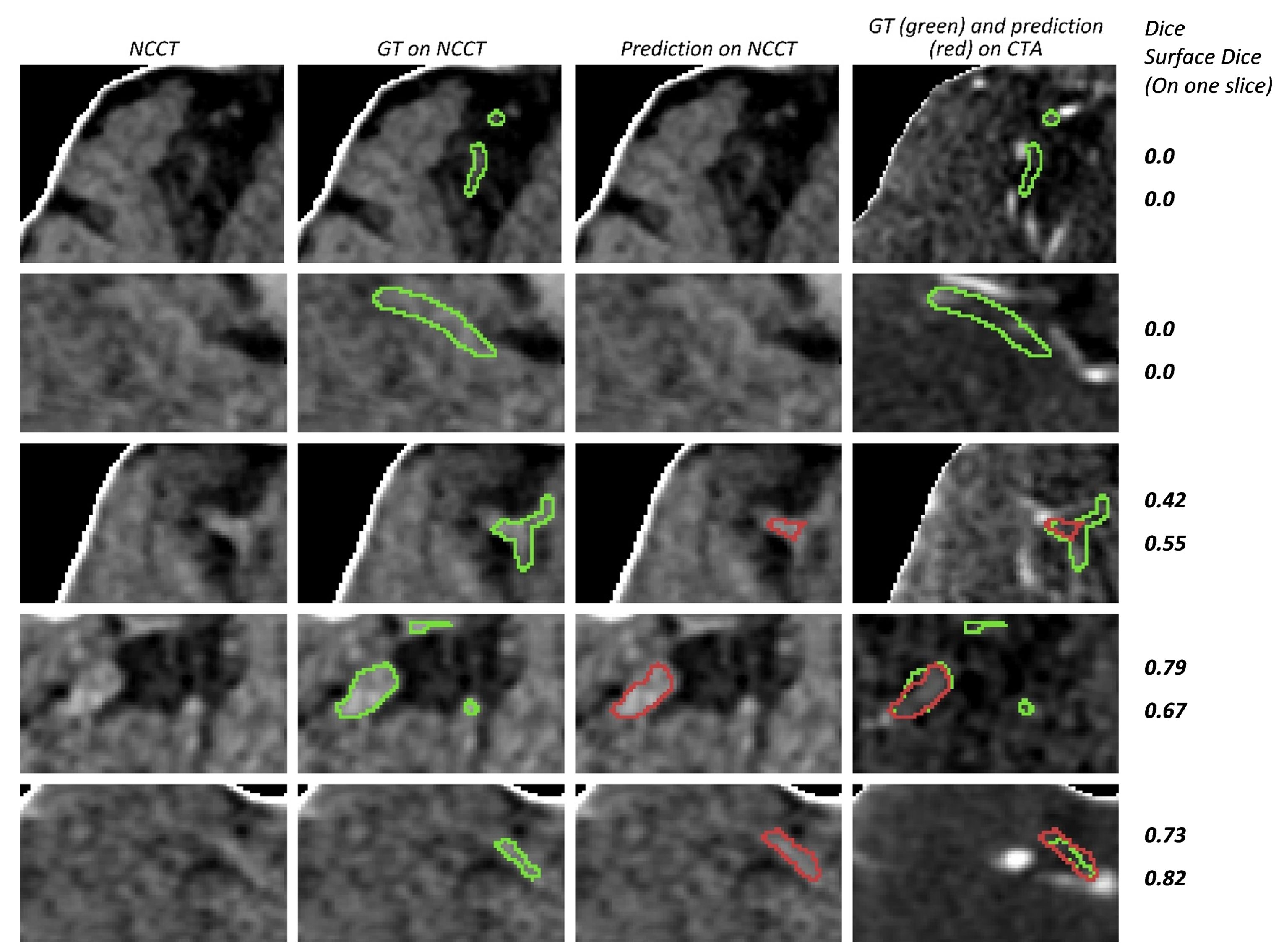 Diagnostics 12 00698 g010