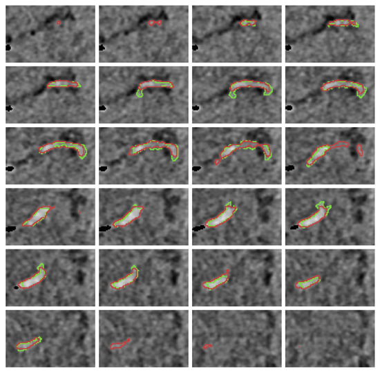 Diagnostics 12 00698 g0a2