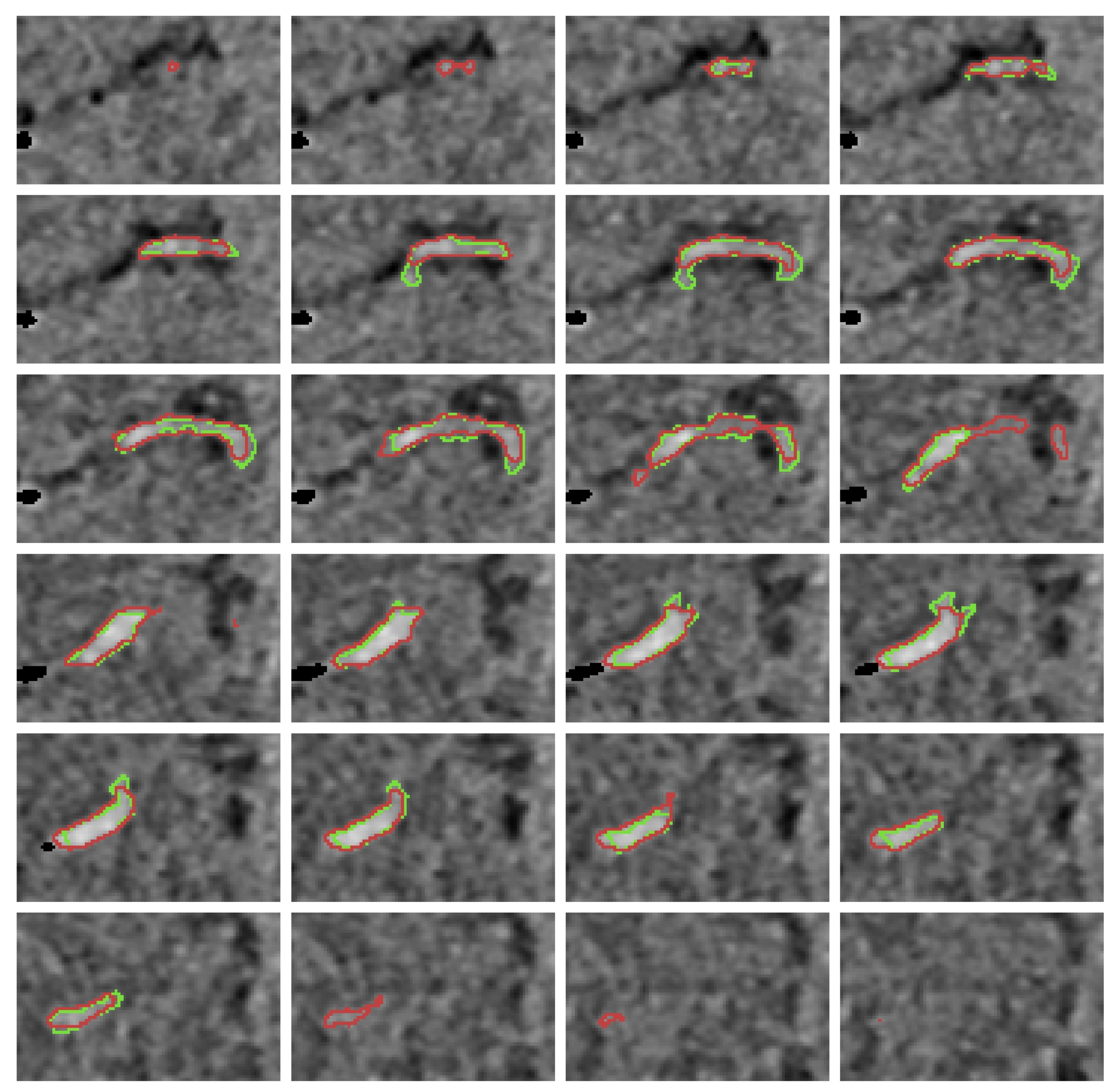 Diagnostics 12 00698 g0a2