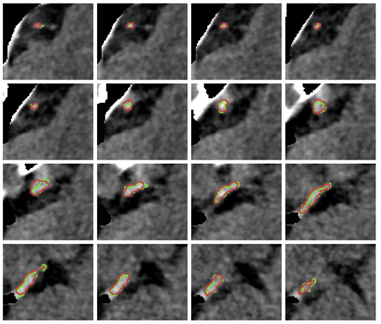Diagnostics 12 00698 g0a3