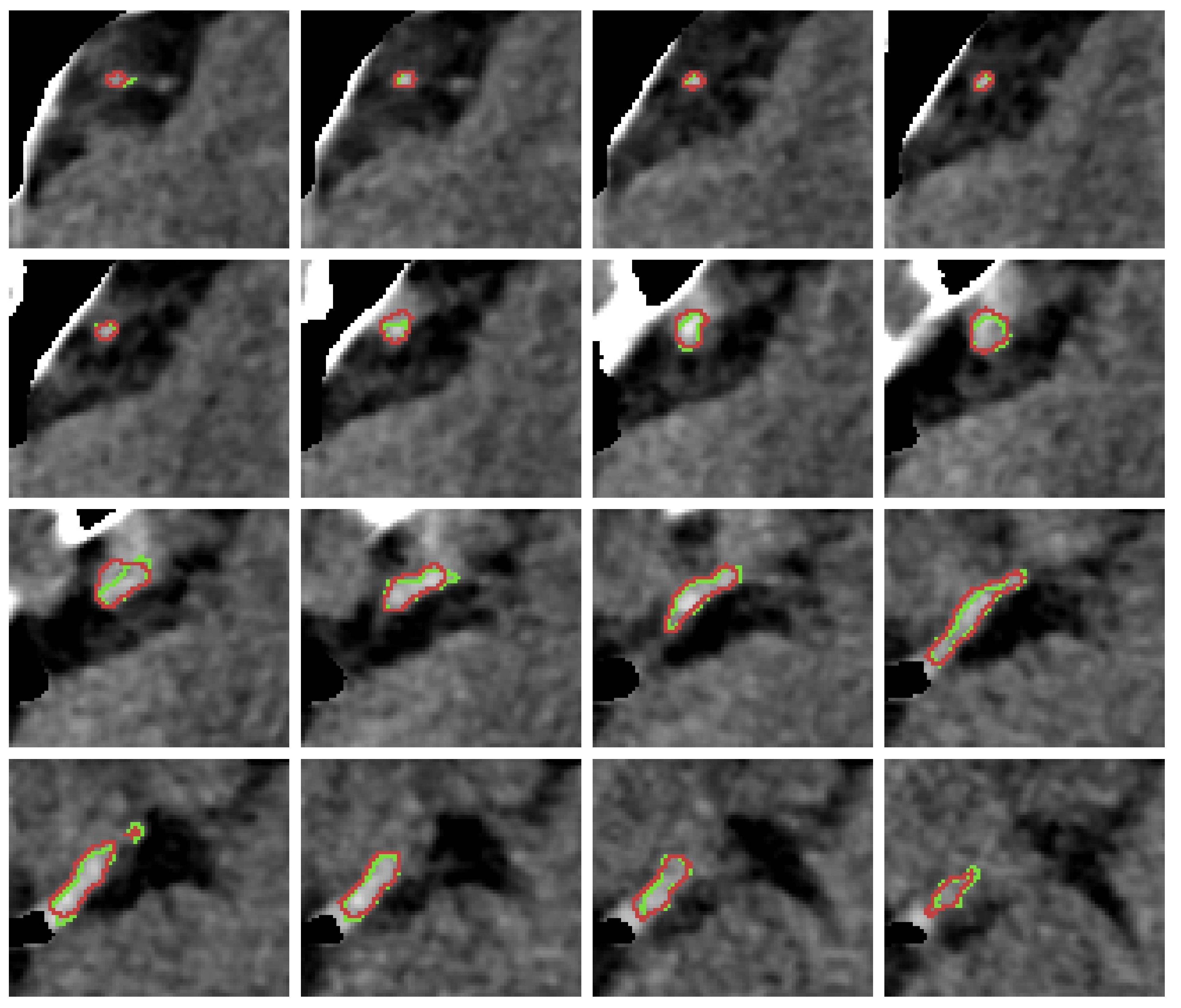 Diagnostics 12 00698 g0a3