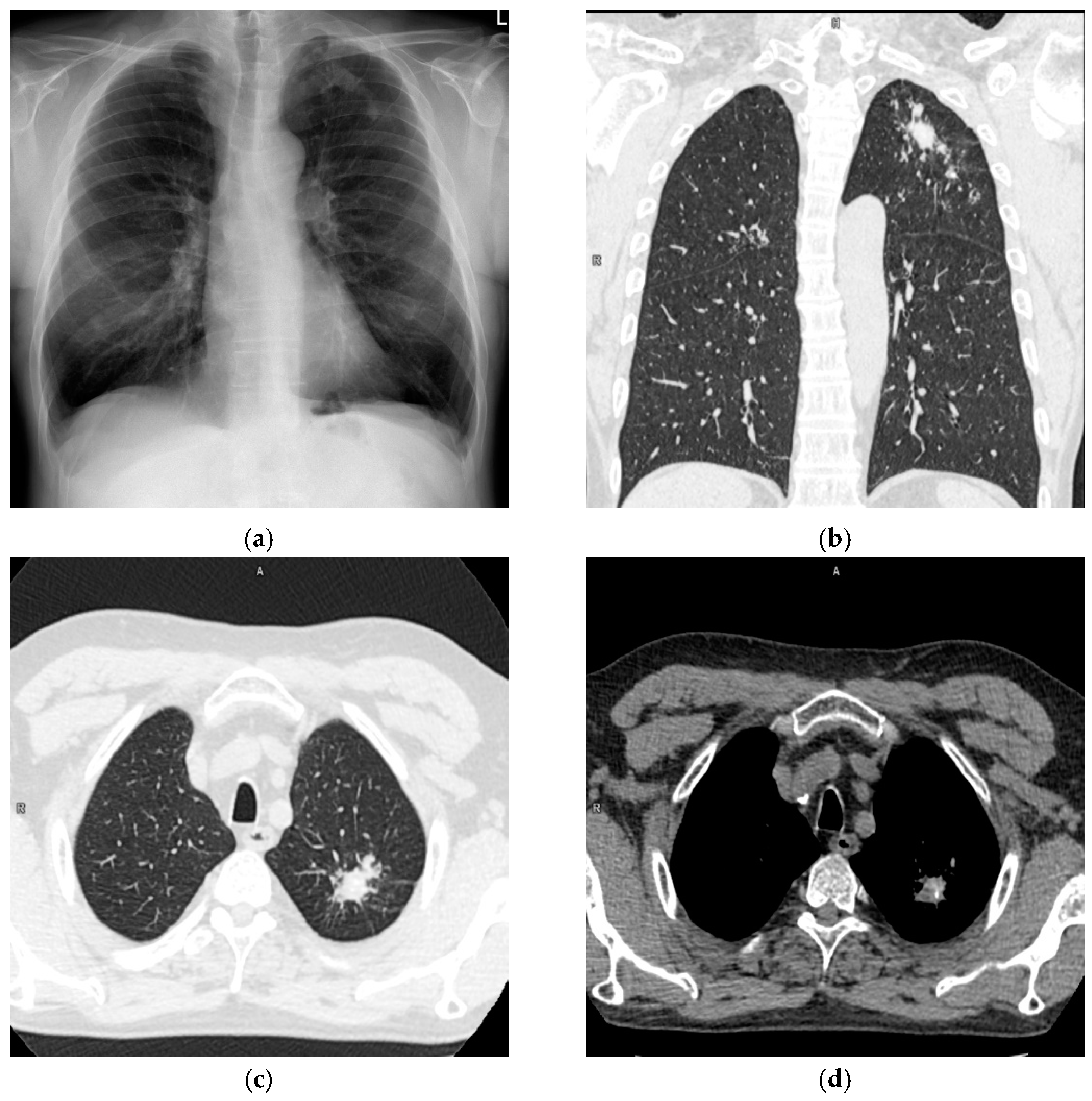 Diagnostics 12 00711 g001