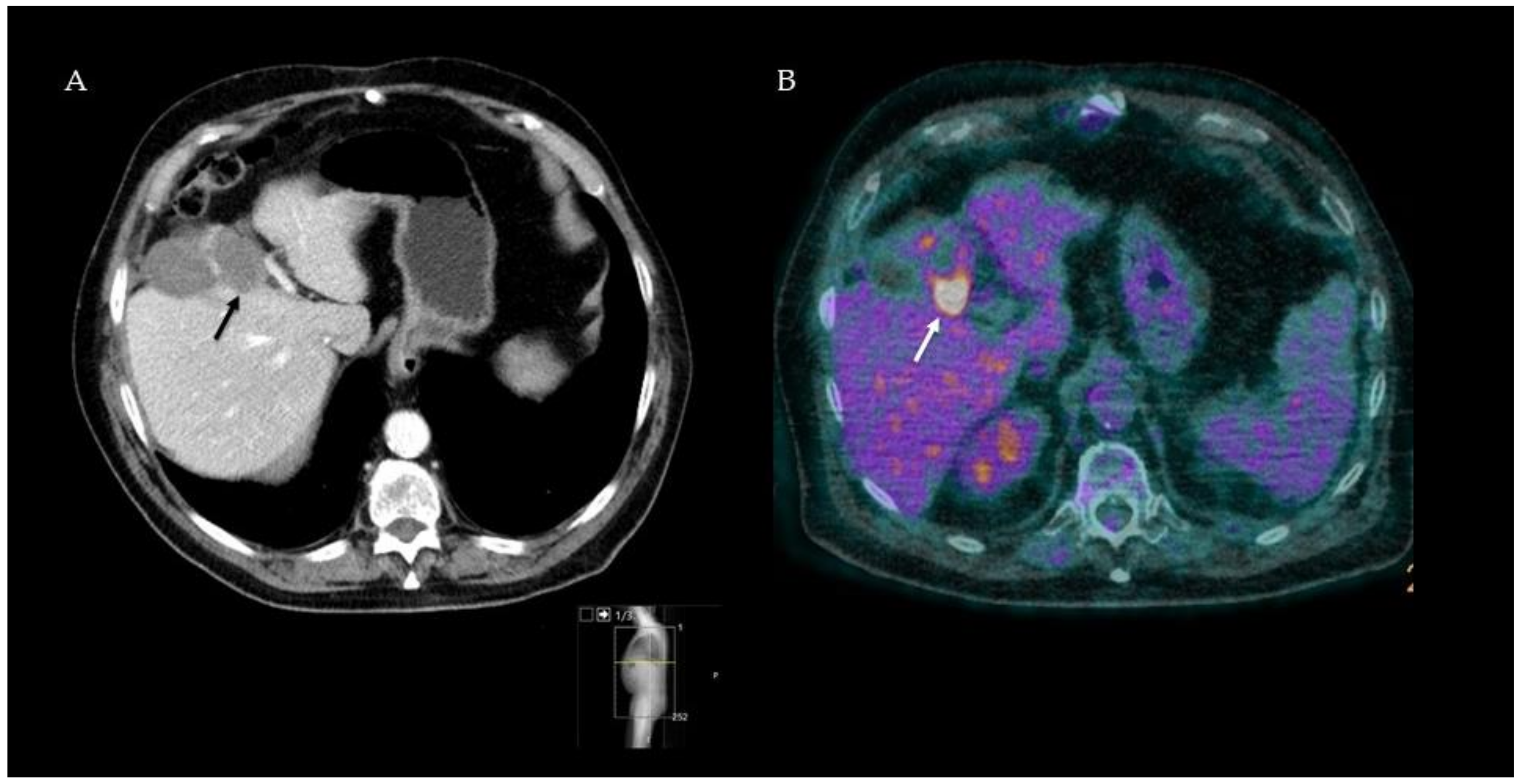 Diagnostics 12 00715 g002 Diagnostics 12 00715 g002