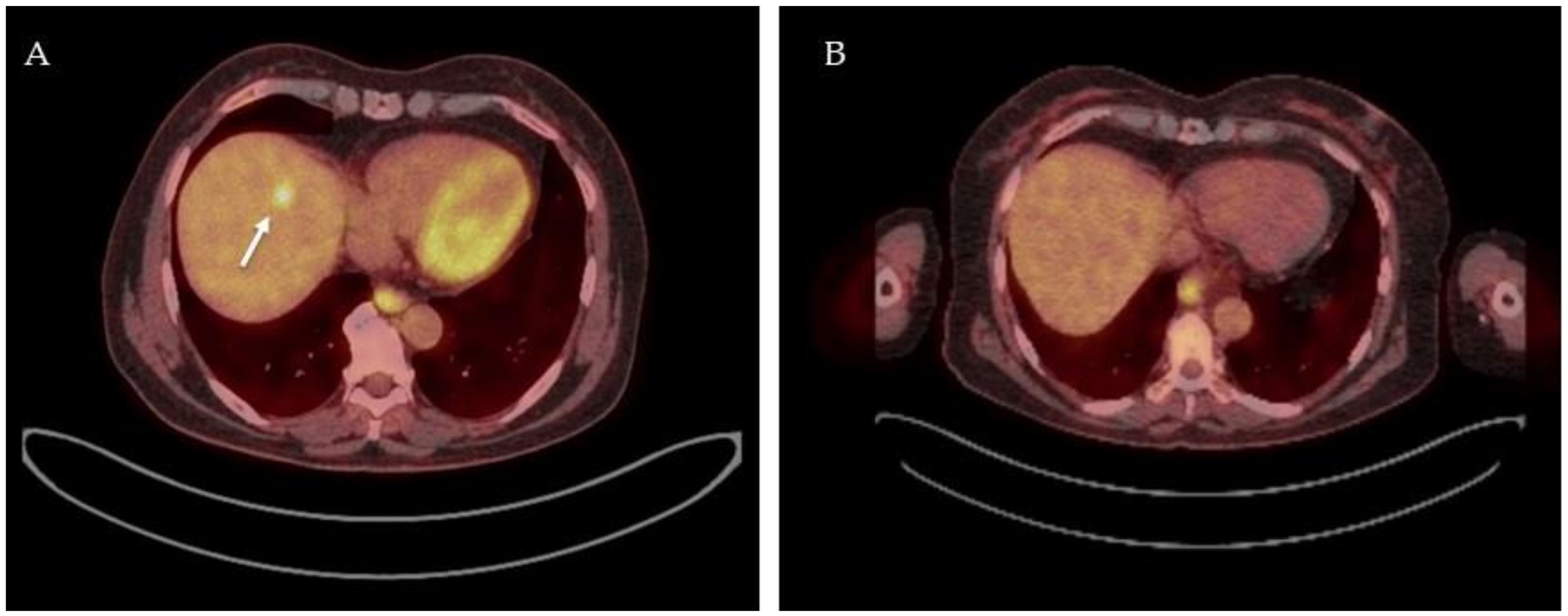 Diagnostics 12 00715 g003 Diagnostics 12 00715 g003