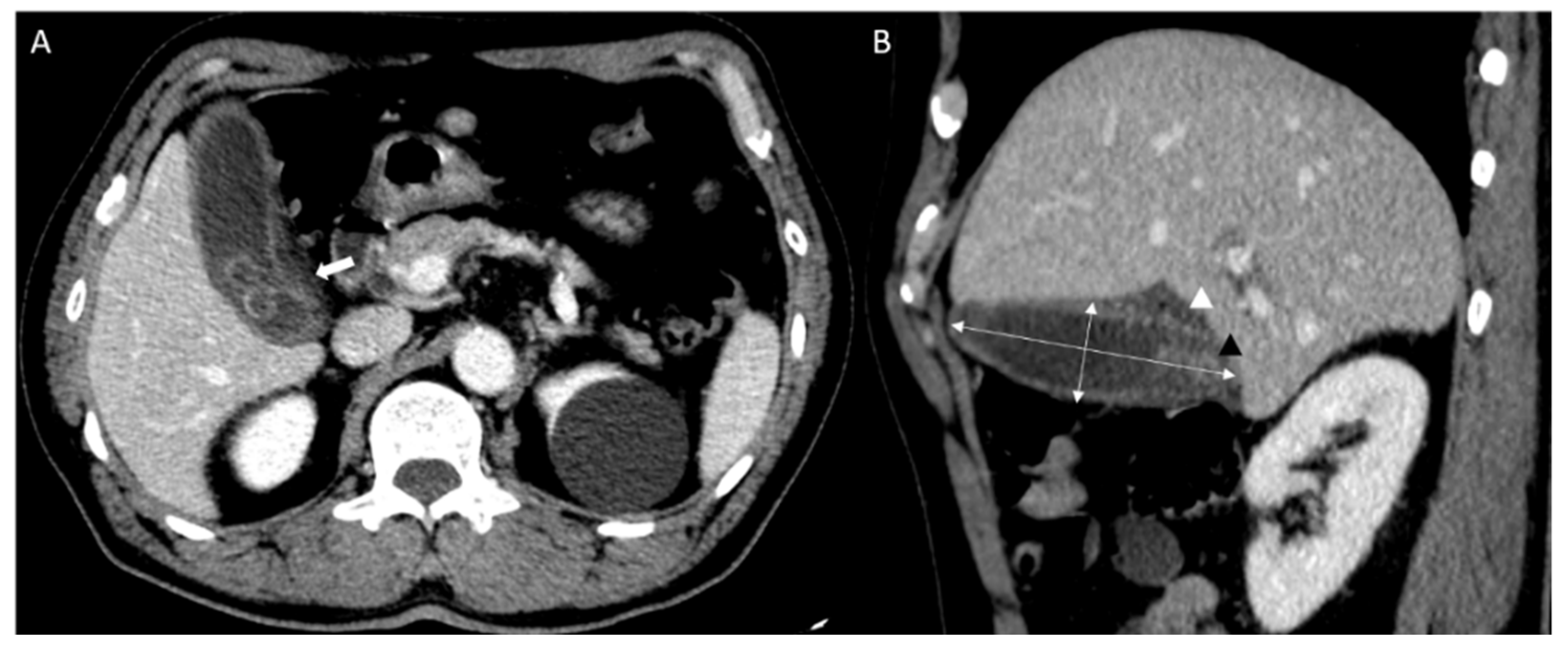 Diagnostics 12 00721 g002