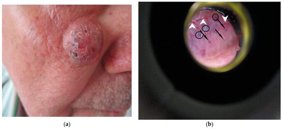 Diagnostics 12 00735 g001 550