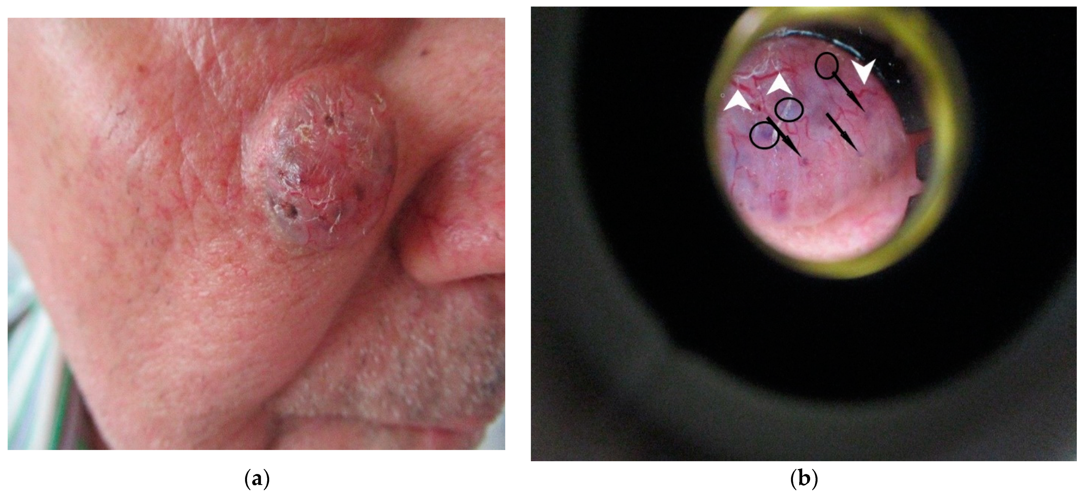 Diagnostics 12 00735 g001