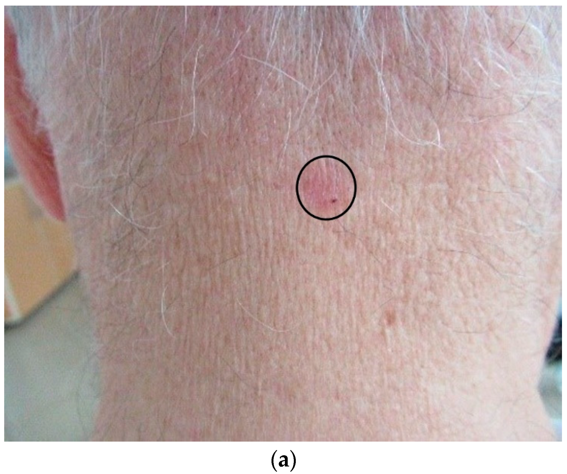 Diagnostics 12 00735 g003a