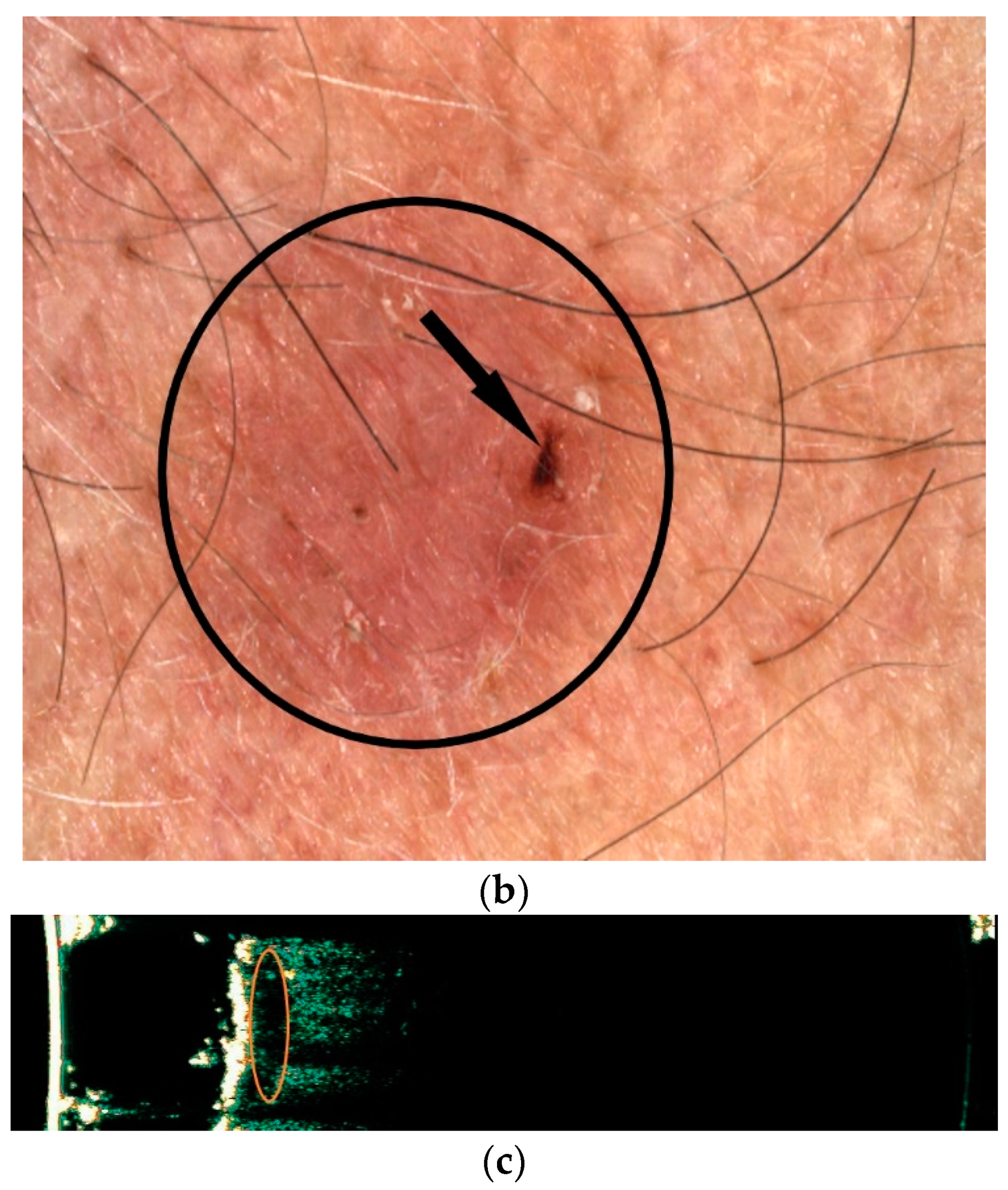 Diagnostics 12 00735 g003b