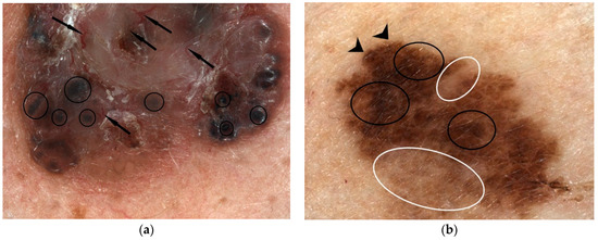 Diagnostics 12 00735 g004 550