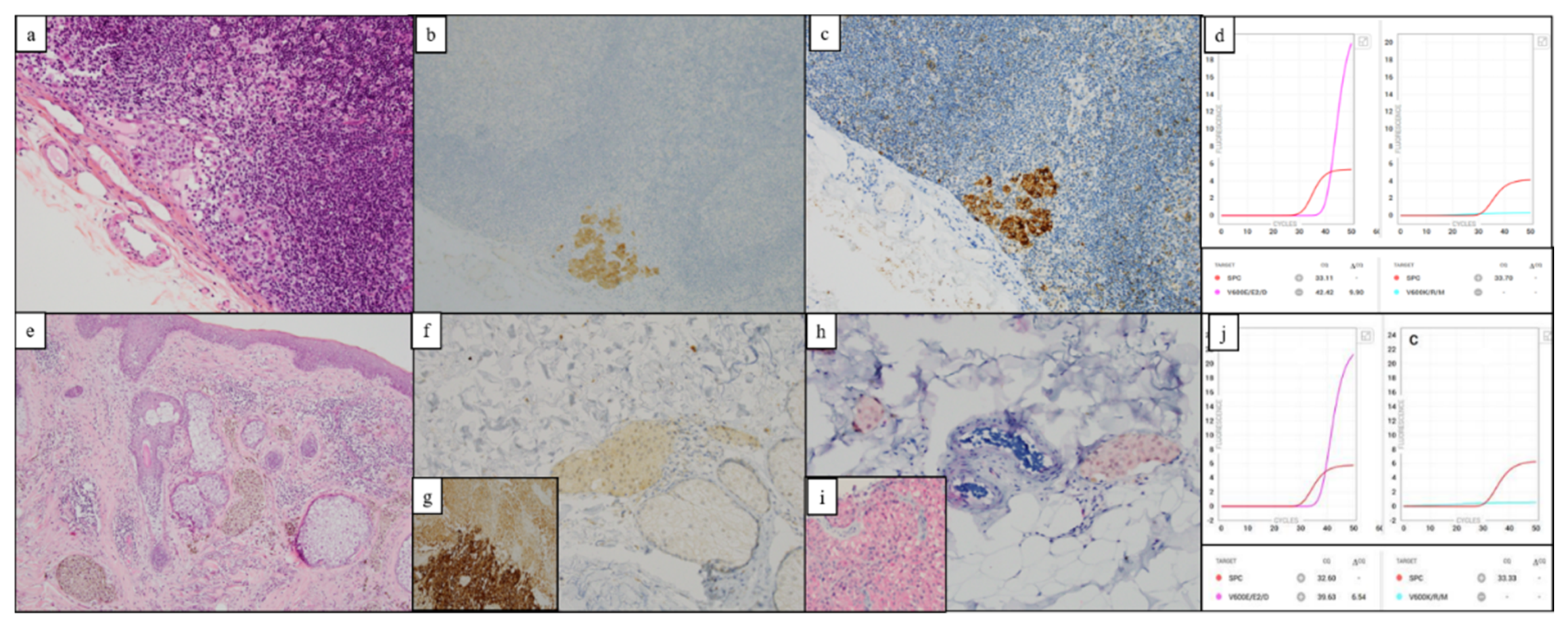 Diagnostics 12 00751 g002