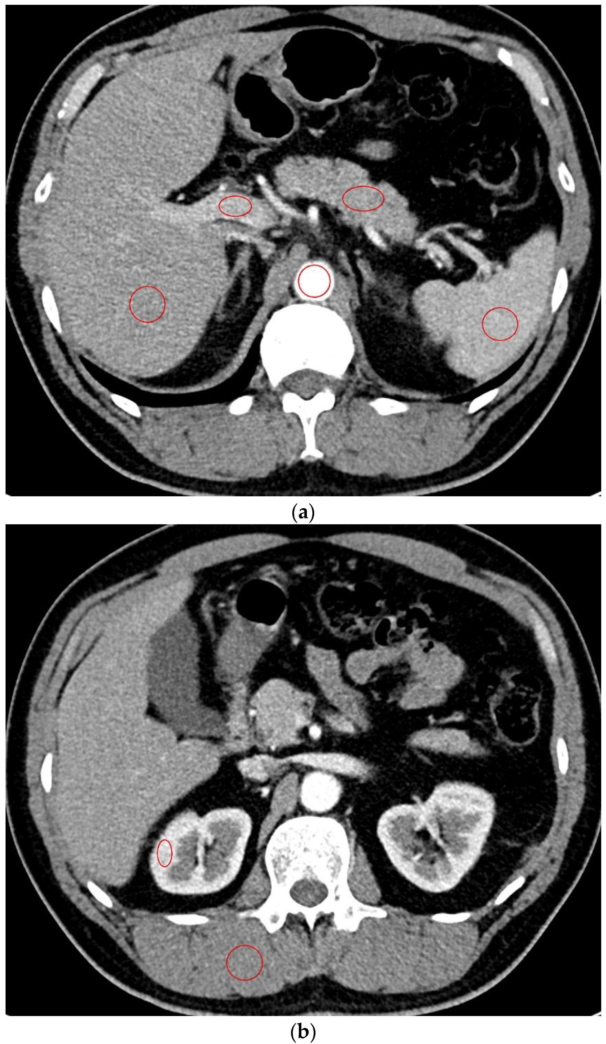 Diagnostics 12 00752 g001